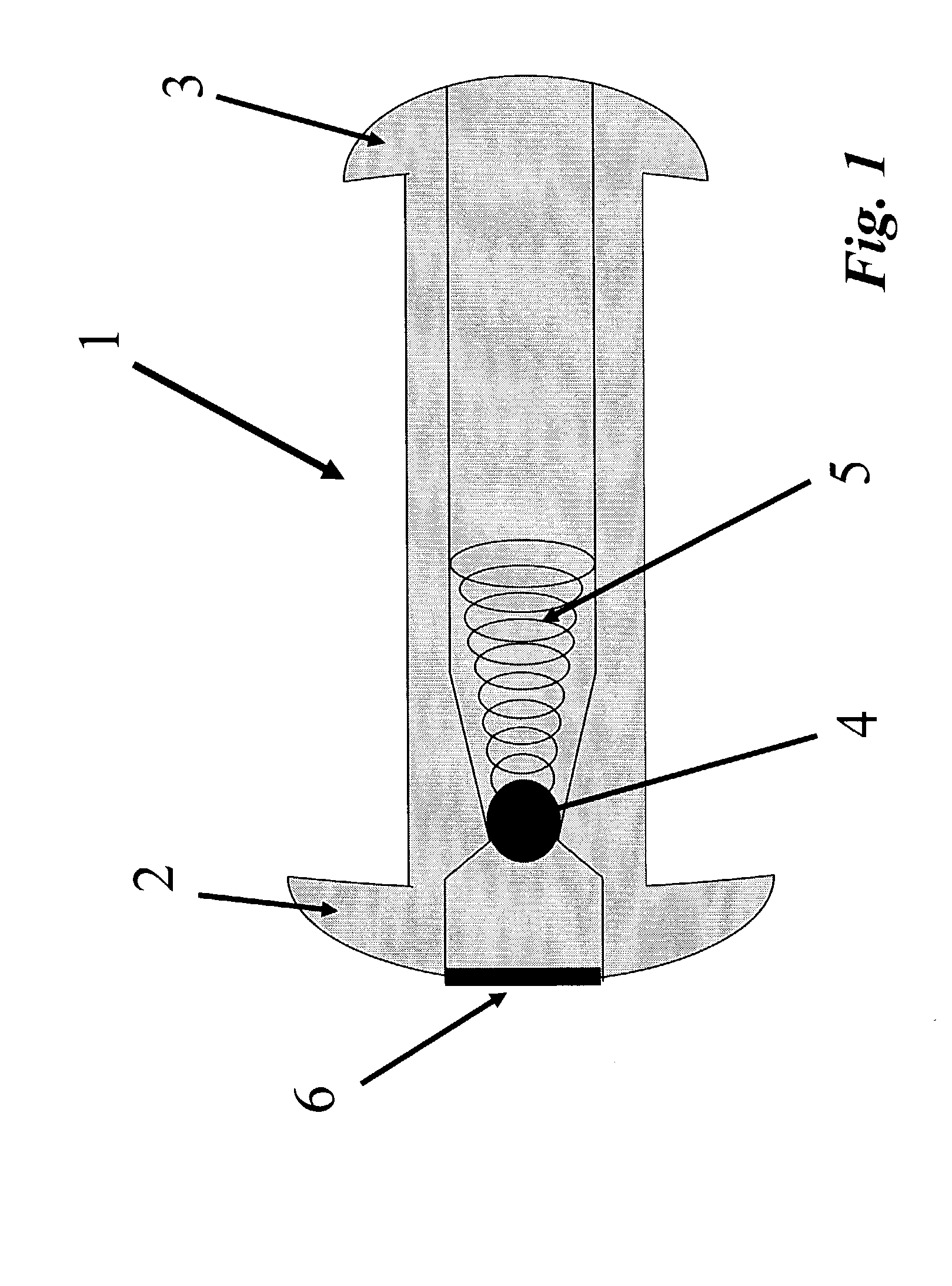 Vesicular shunt for the drainage of excess fluid