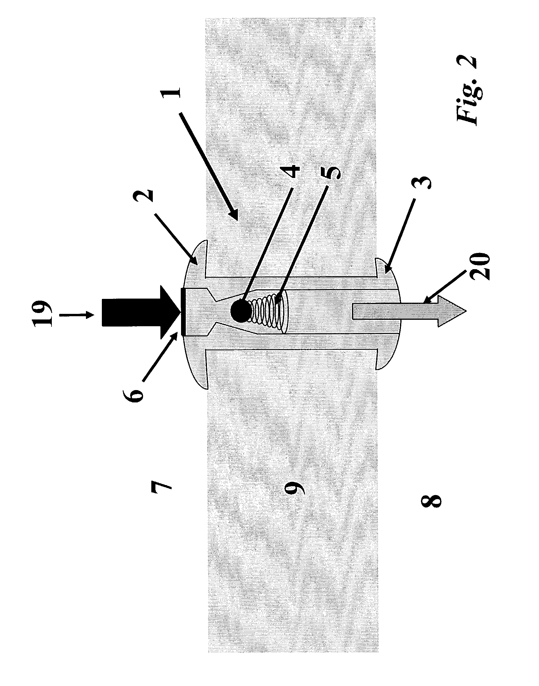 Vesicular shunt for the drainage of excess fluid