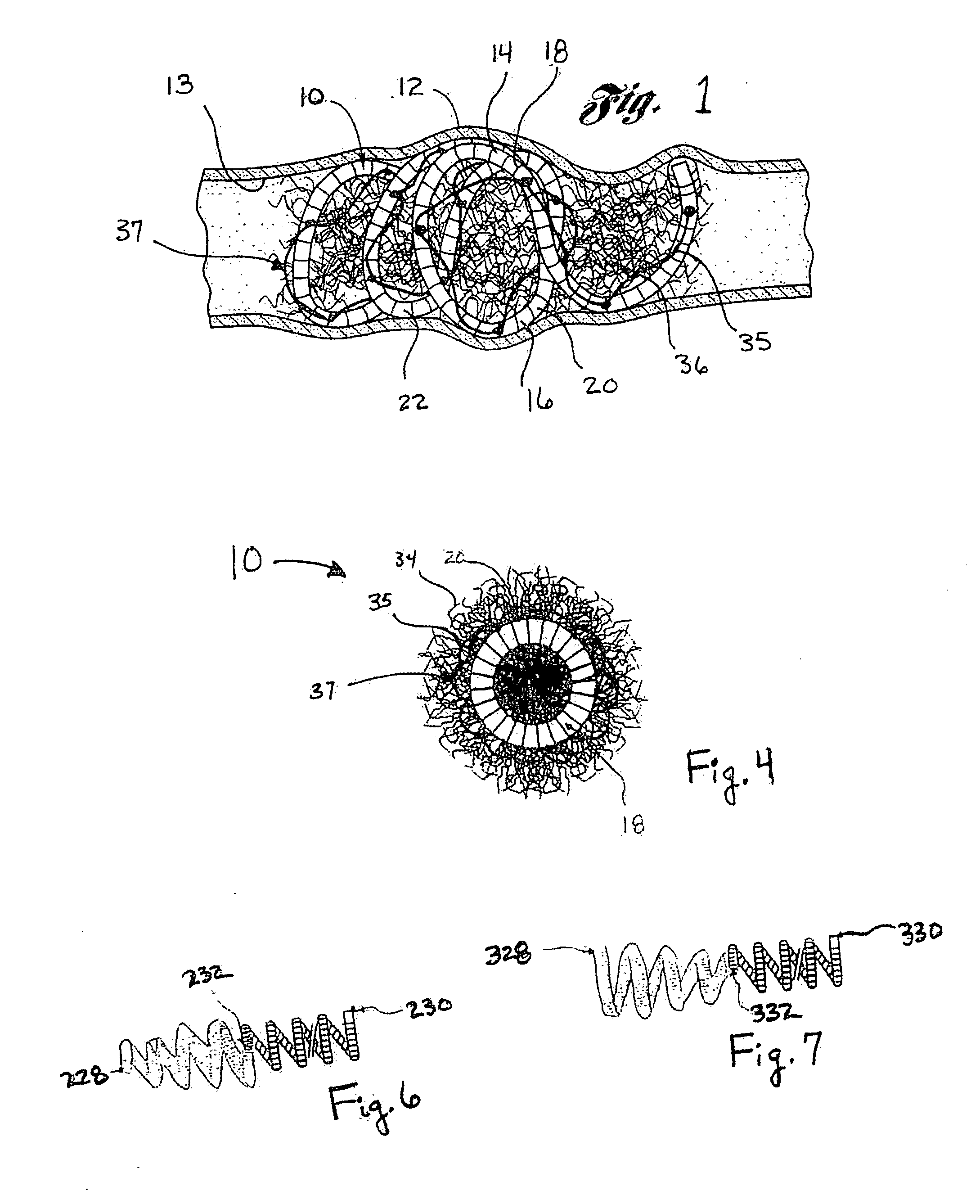 Spiral occluding device with an occlusion sail