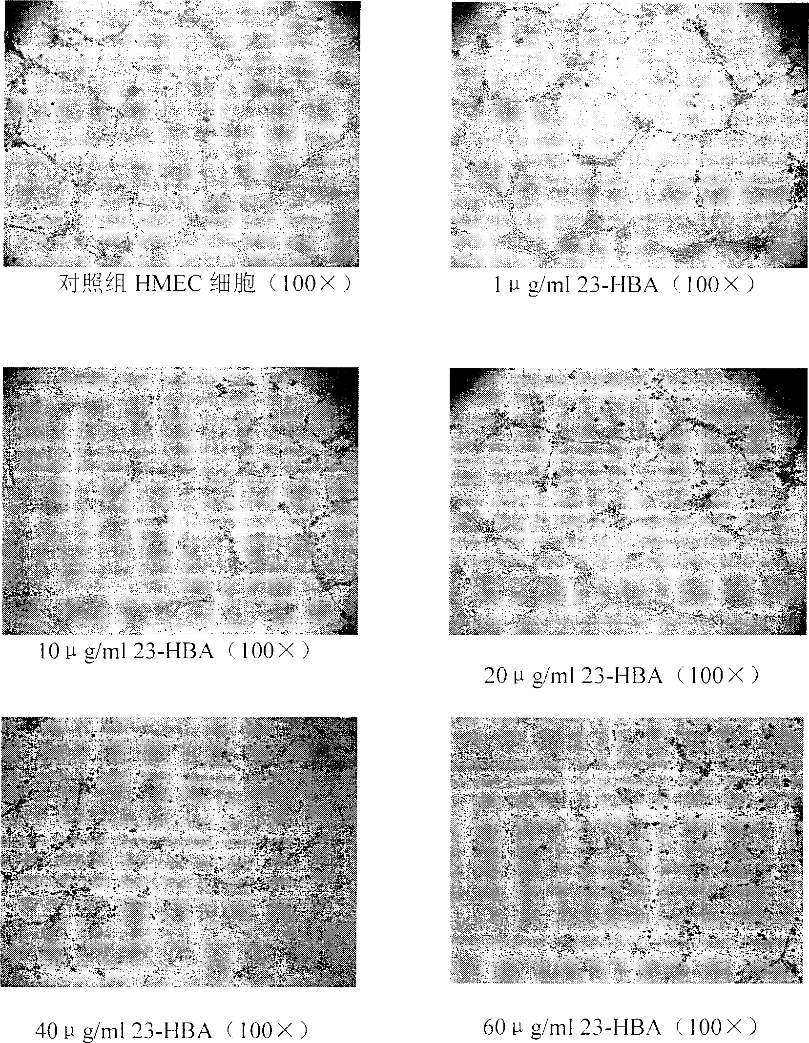 Use of 23-hydroxy betulic acid in inhibiting blood vessel formation