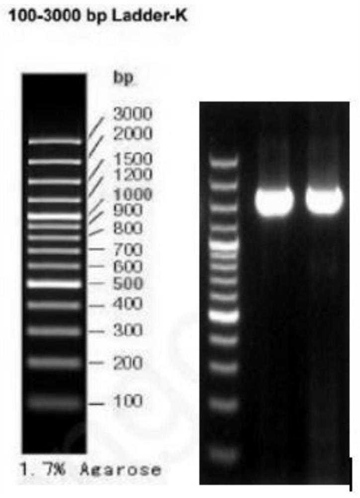 Lactobacillus rhamnosus, fermentation lysate for regulating skin micro-ecology, preparation method and application of lactobacillus rhamnosus and fermentation lysate