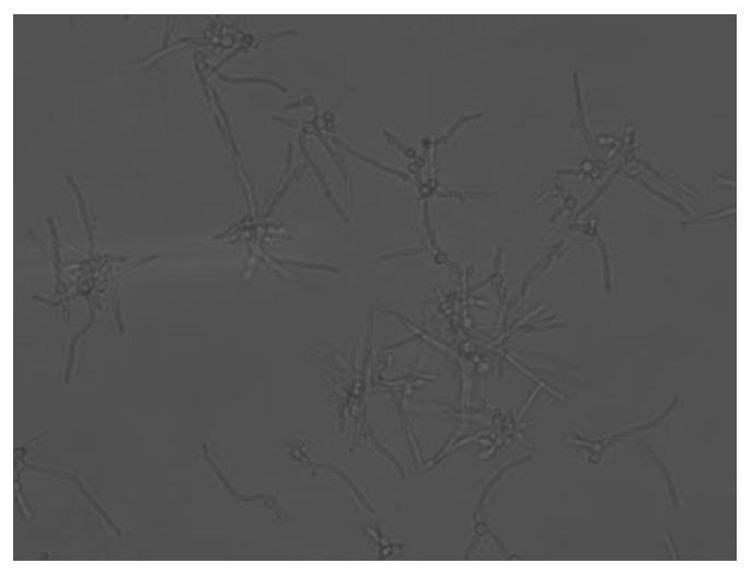 Lactobacillus rhamnosus, fermentation lysate for regulating skin micro-ecology, preparation method and application of lactobacillus rhamnosus and fermentation lysate