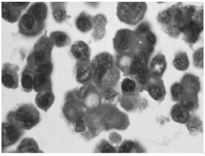 Cell line sourced from later-stage gastric signet ring cell cancer, and establishing method and application thereof