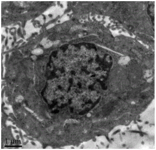 Cell line sourced from later-stage gastric signet ring cell cancer, and establishing method and application thereof