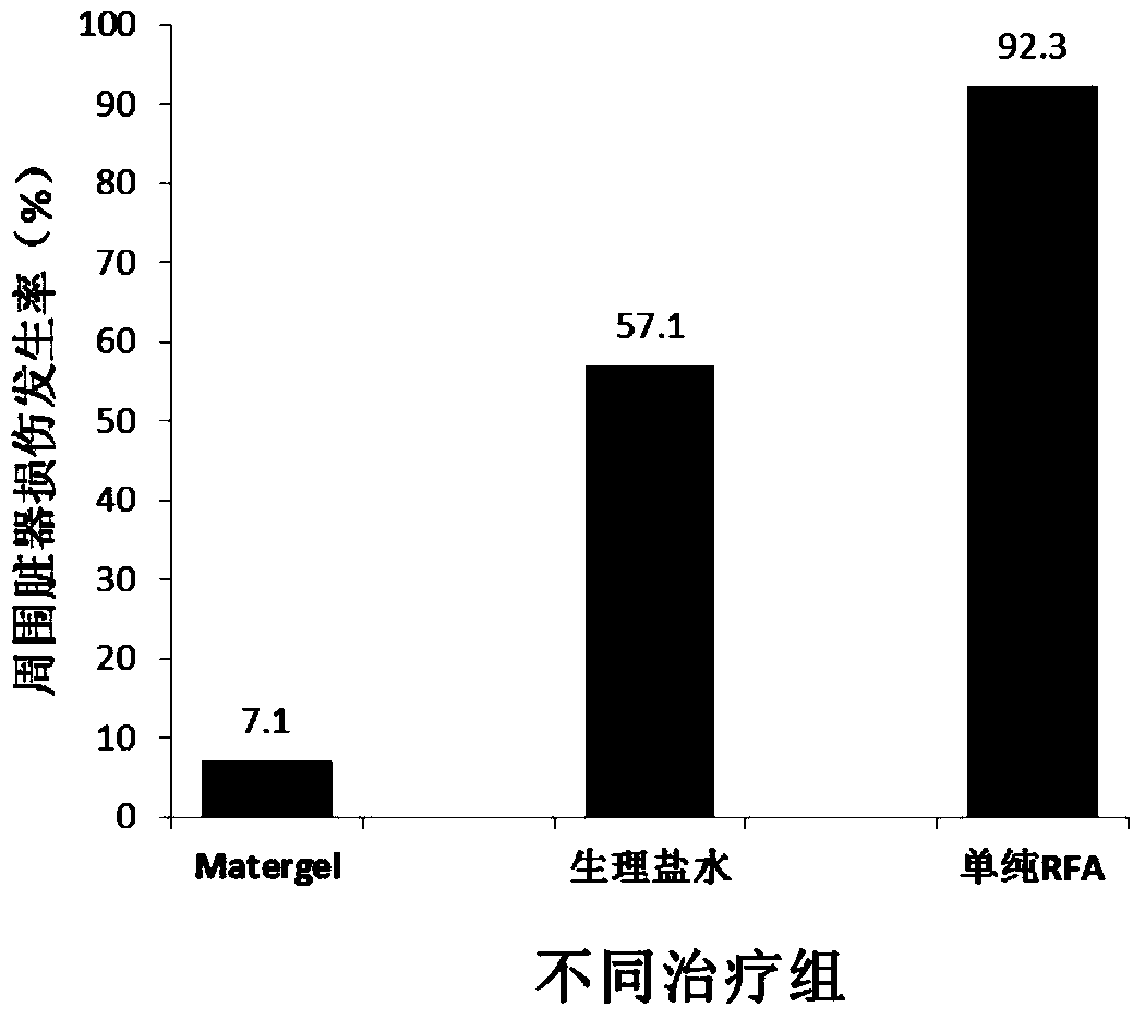 Application of heat-sensitive materials in the preparation of injections for protecting the surrounding structures of organs during thermal ablation