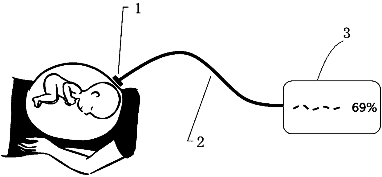 Non-invasion-type detection instrument and method for cerebral blood oxygen of fetus in abdomen