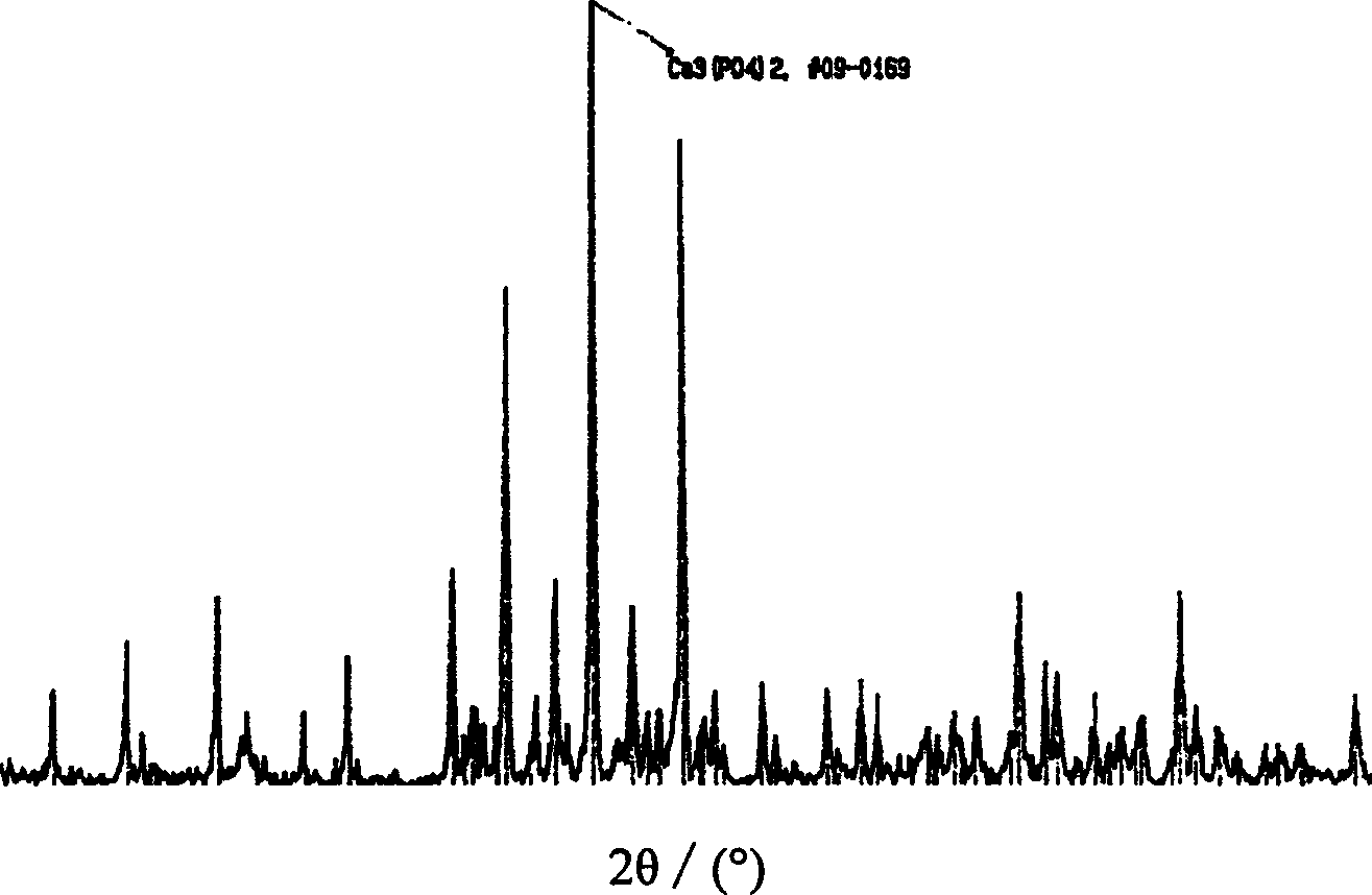 Preparation of powder of beta-TCP bioceramic possessing crystal grain structure of laminar cleavage