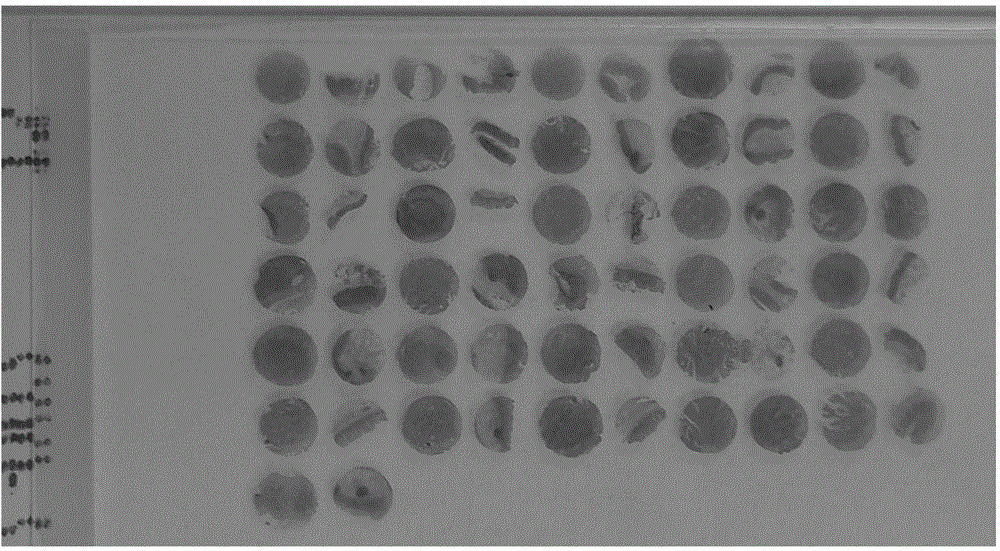 Application of METRNL protein as colon cancer diagnostic marker and kit