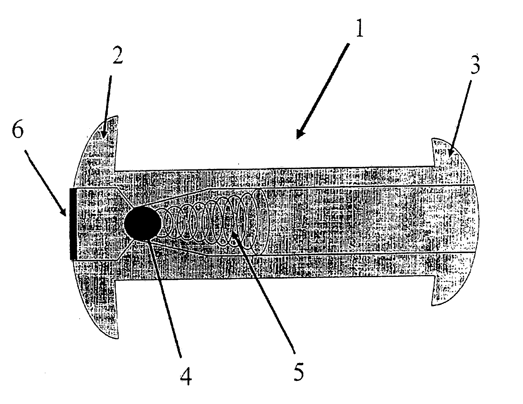 Implantable fluid management system for the removal of excess fluid