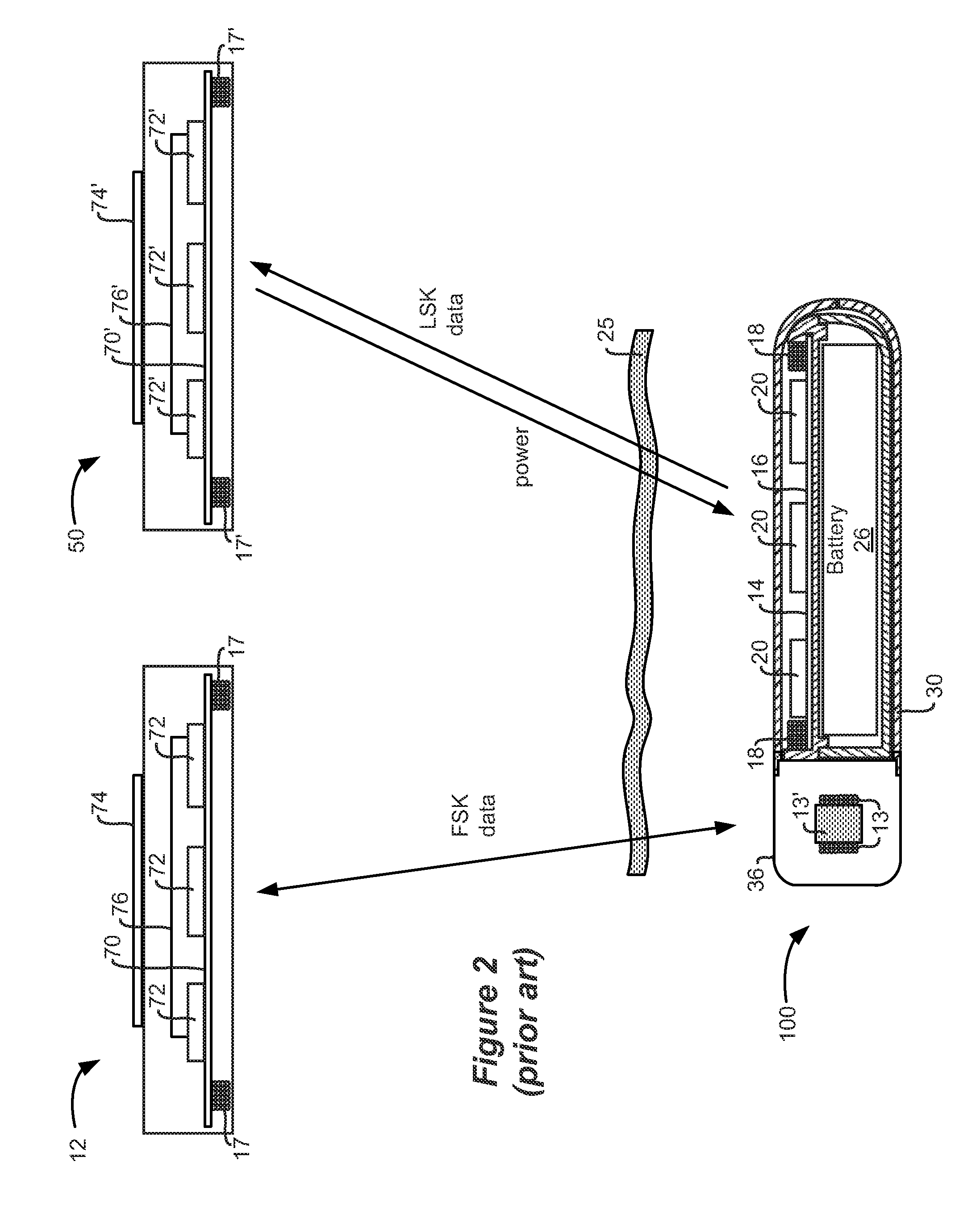 External Controller/Charger System for an Implantable Medical Device Capable of Automatically Providing Data Telemetry Through a Charging Coil During a Charging Session