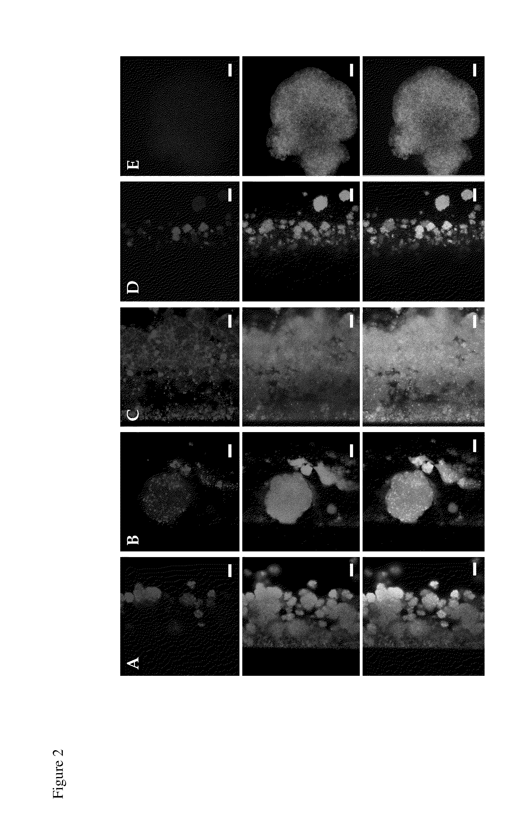 Protective vaccine against staphylococcus aureus biofilms comprising cell wall-associated immunogens