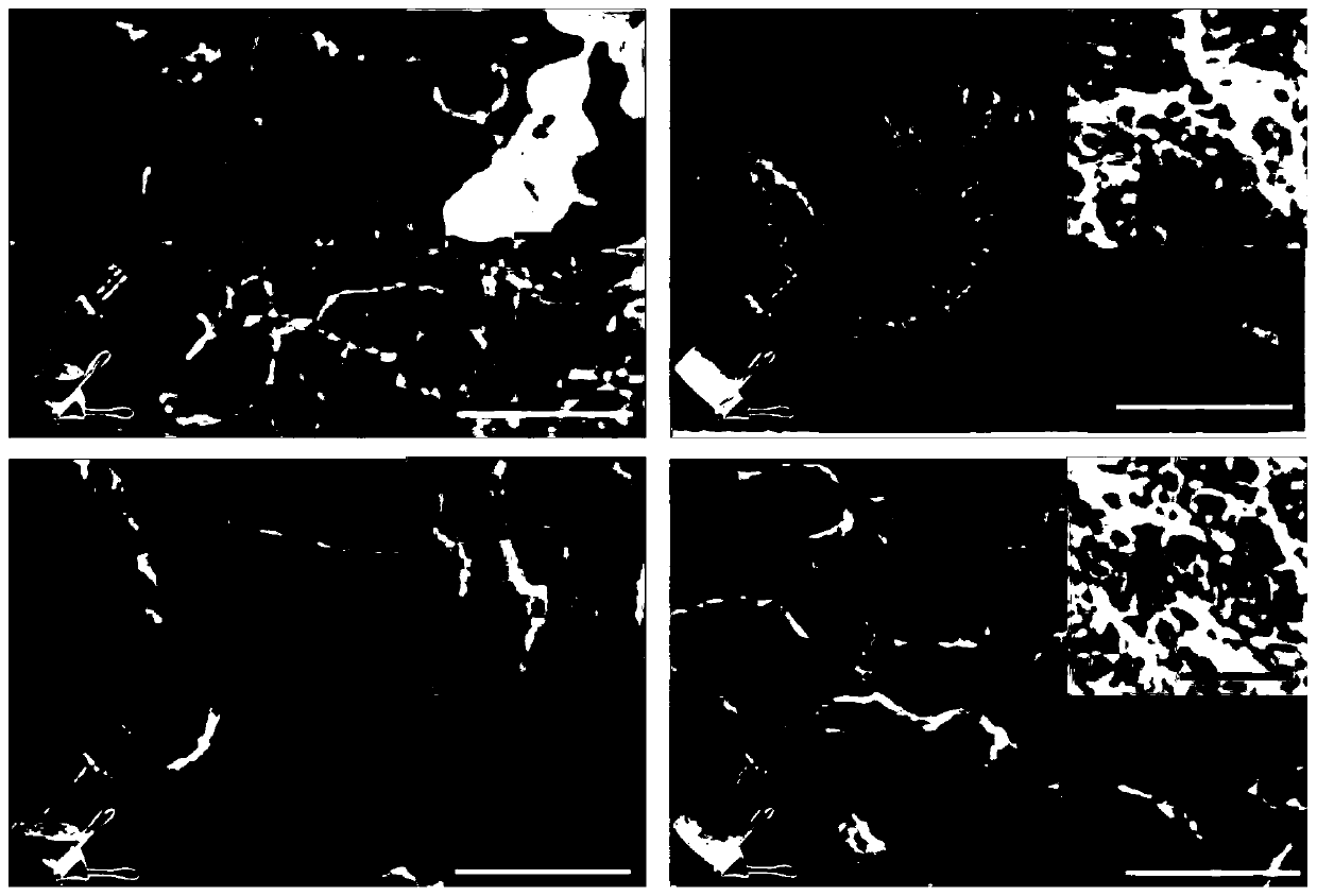 Preparation method, product, and application of silk fibroin-based thixotropic hydrogel