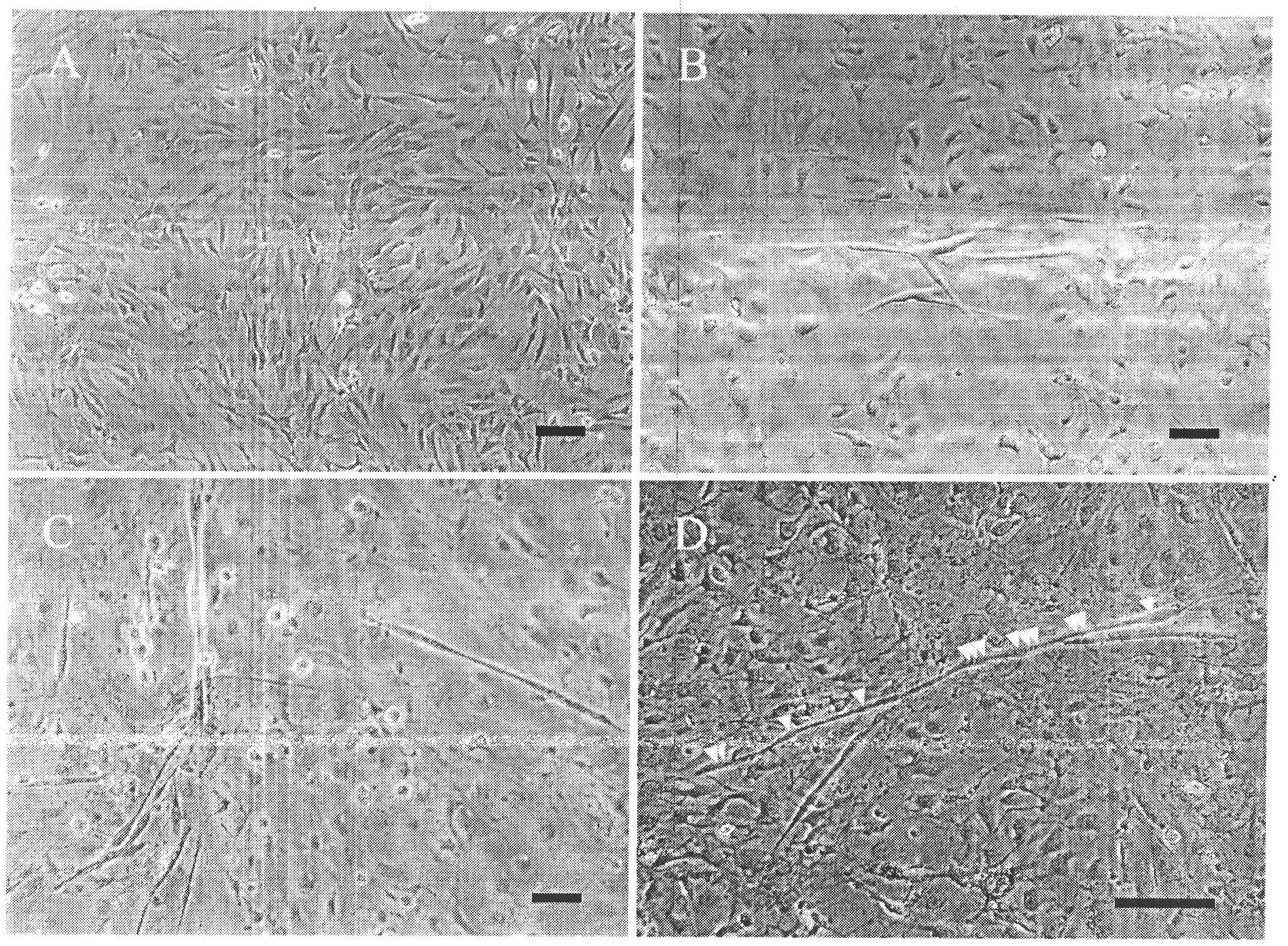 Culture solution for differentiating adipose-derived stromal cells into myocardial cells and preparation method thereof