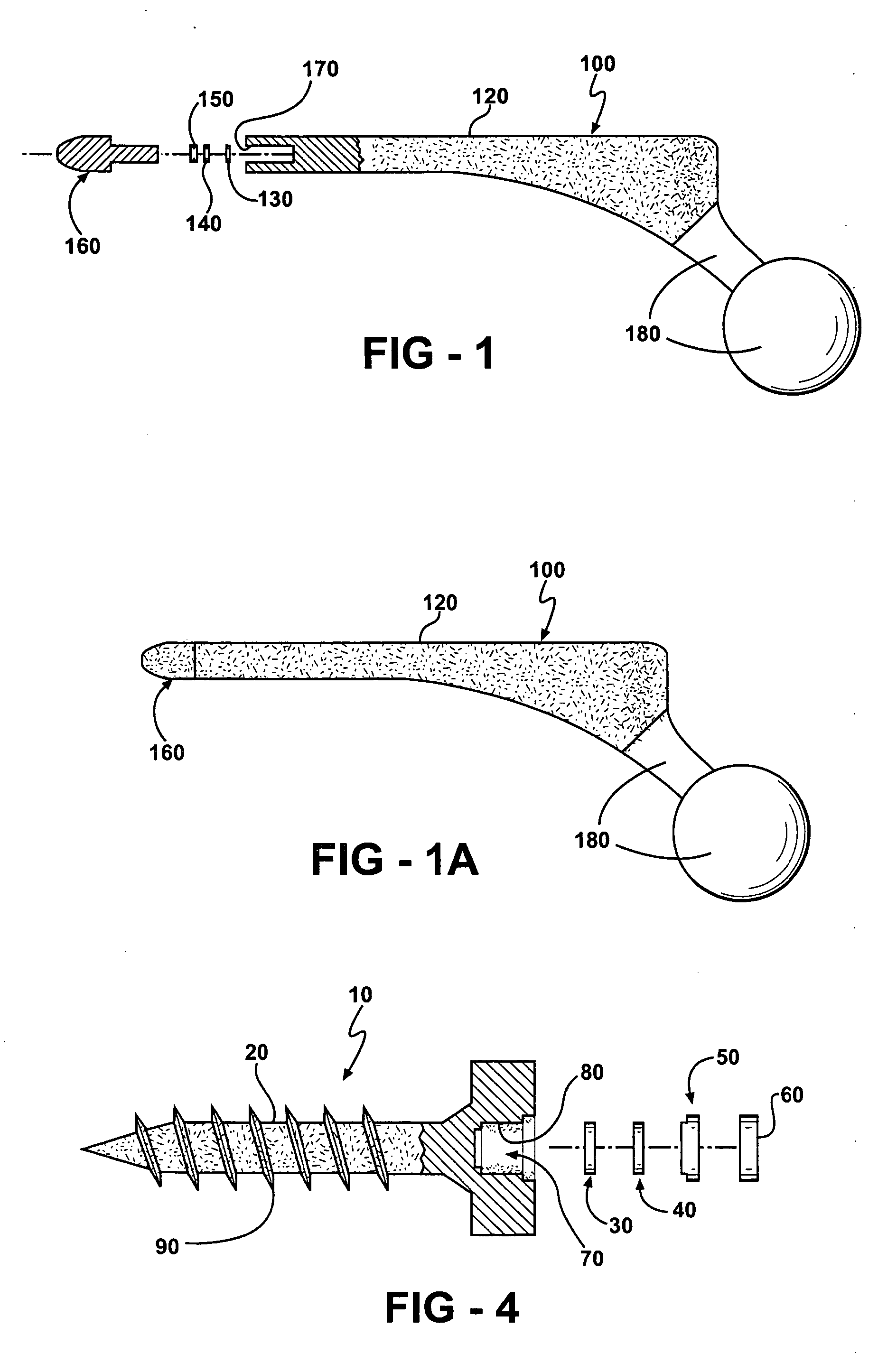 Prophylactic bactericidal implant