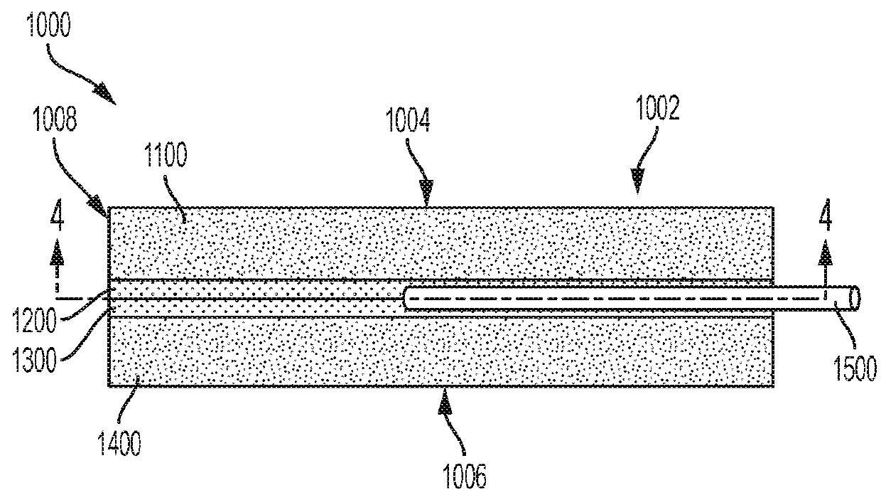 Integrated aqueous shunt for glaucoma treatment