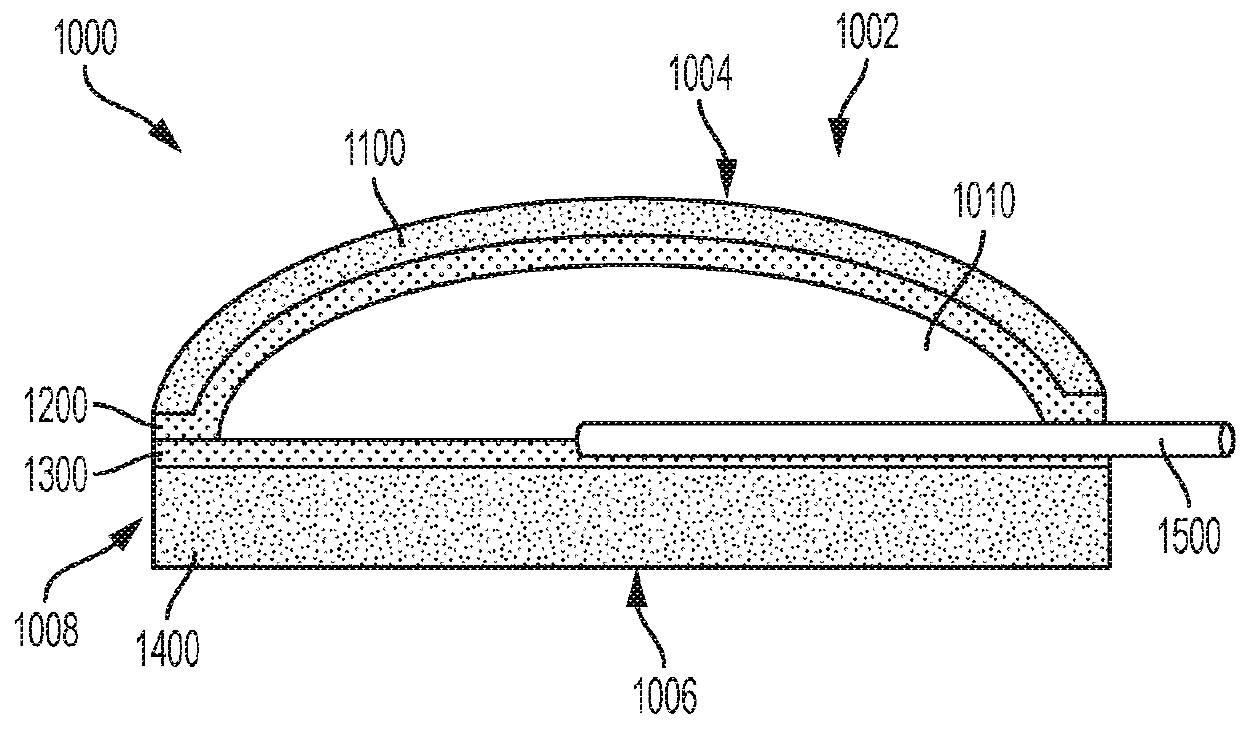 Integrated aqueous shunt for glaucoma treatment