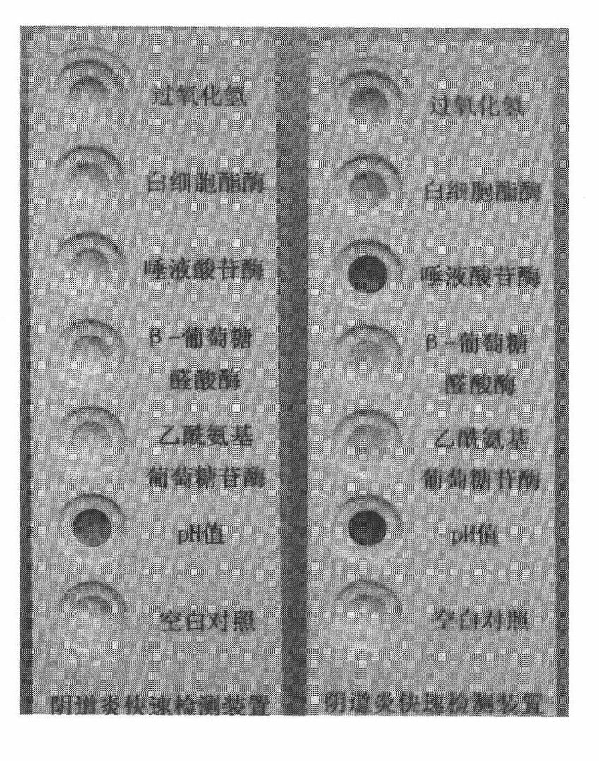 Vaginitis test kit and preparation method thereof