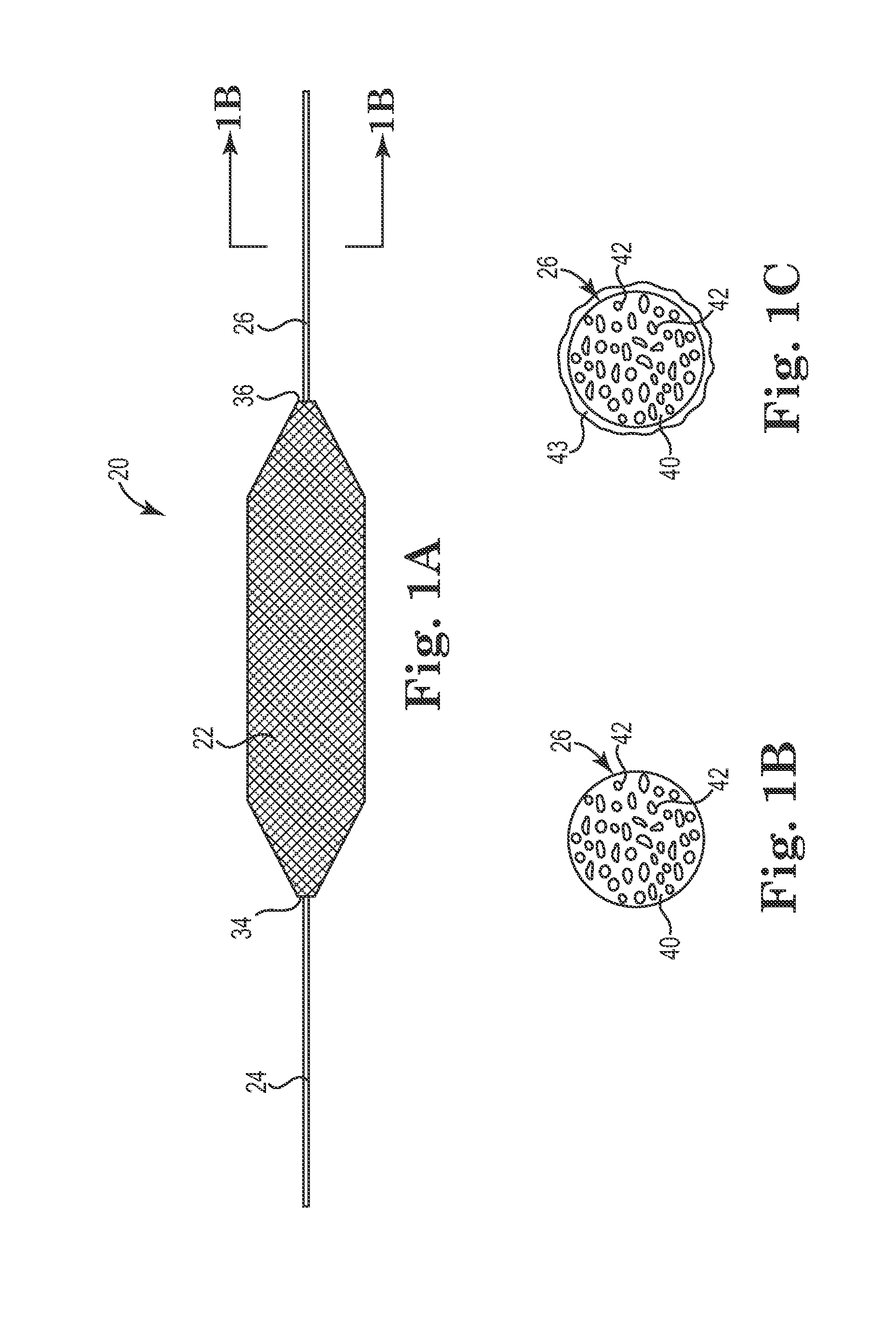 Method of treating incontinence