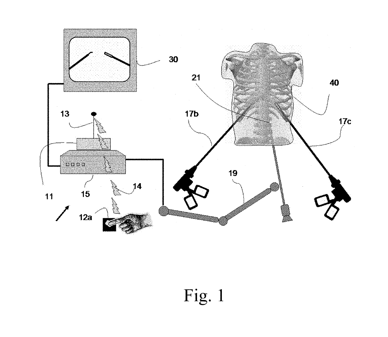 Device and method for assisting laparoscopic surgery—rule based approach