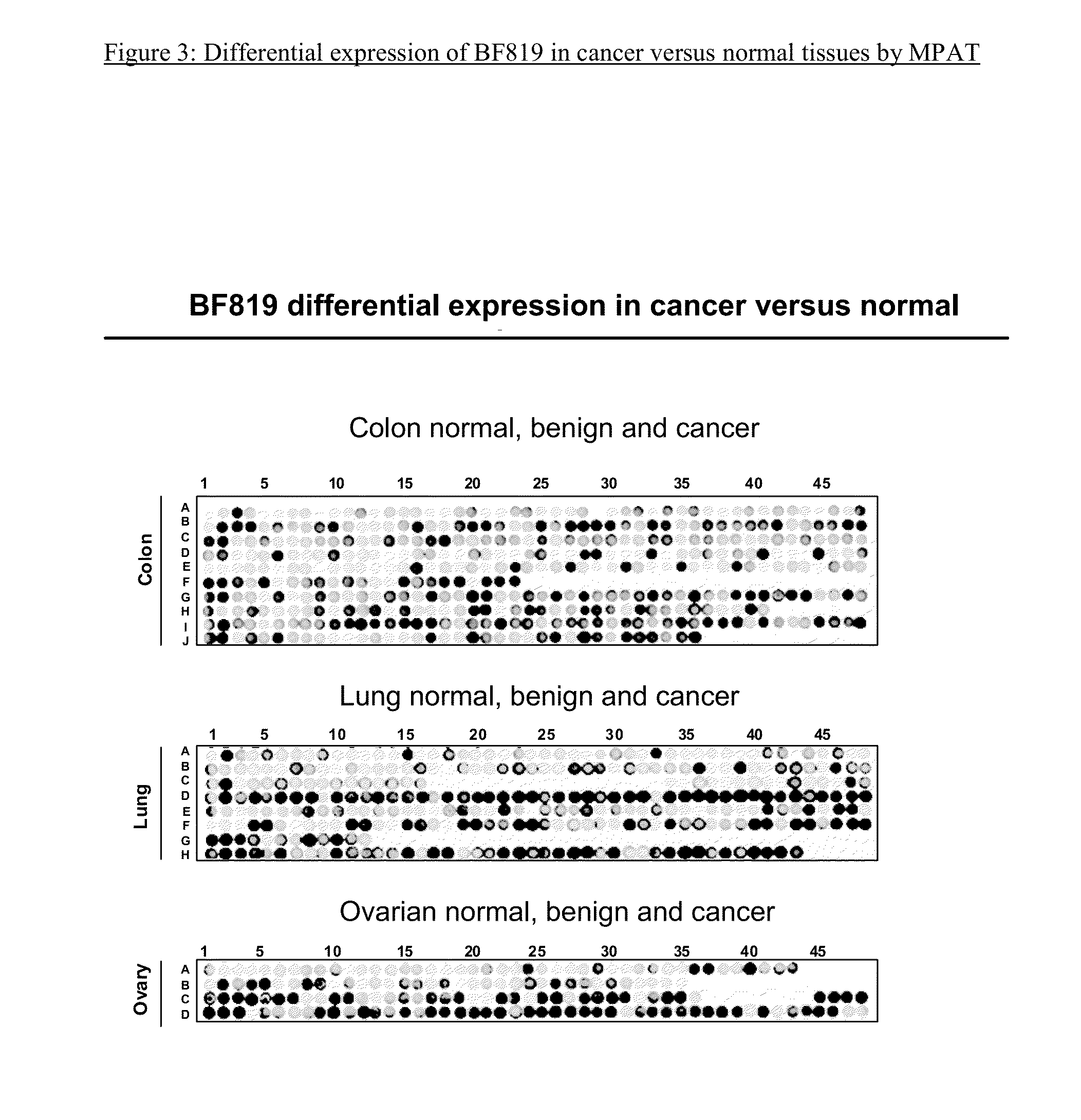 Biological marker for early cancer detection and methods for cancer detection (BF819)