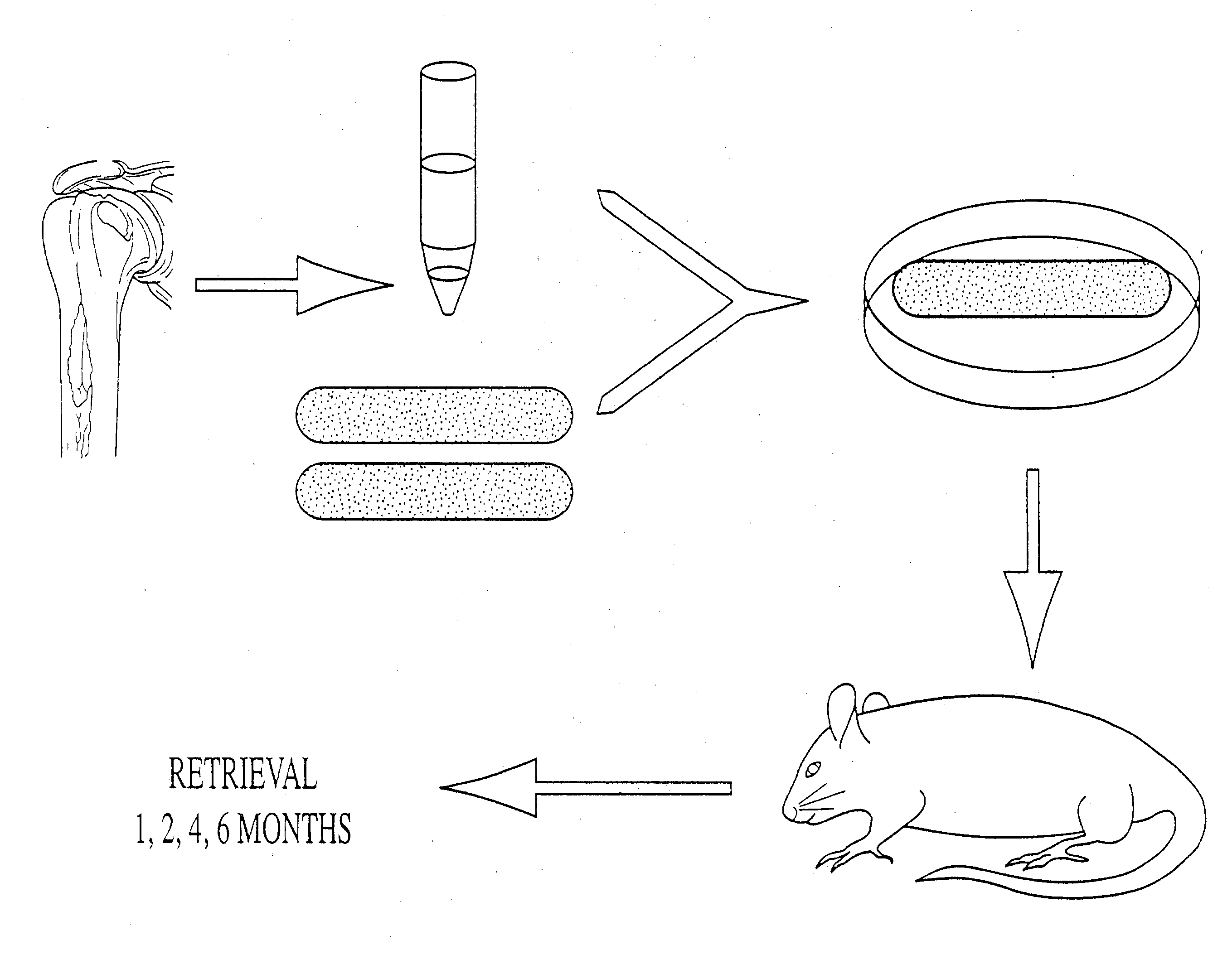 Penile reconstruction