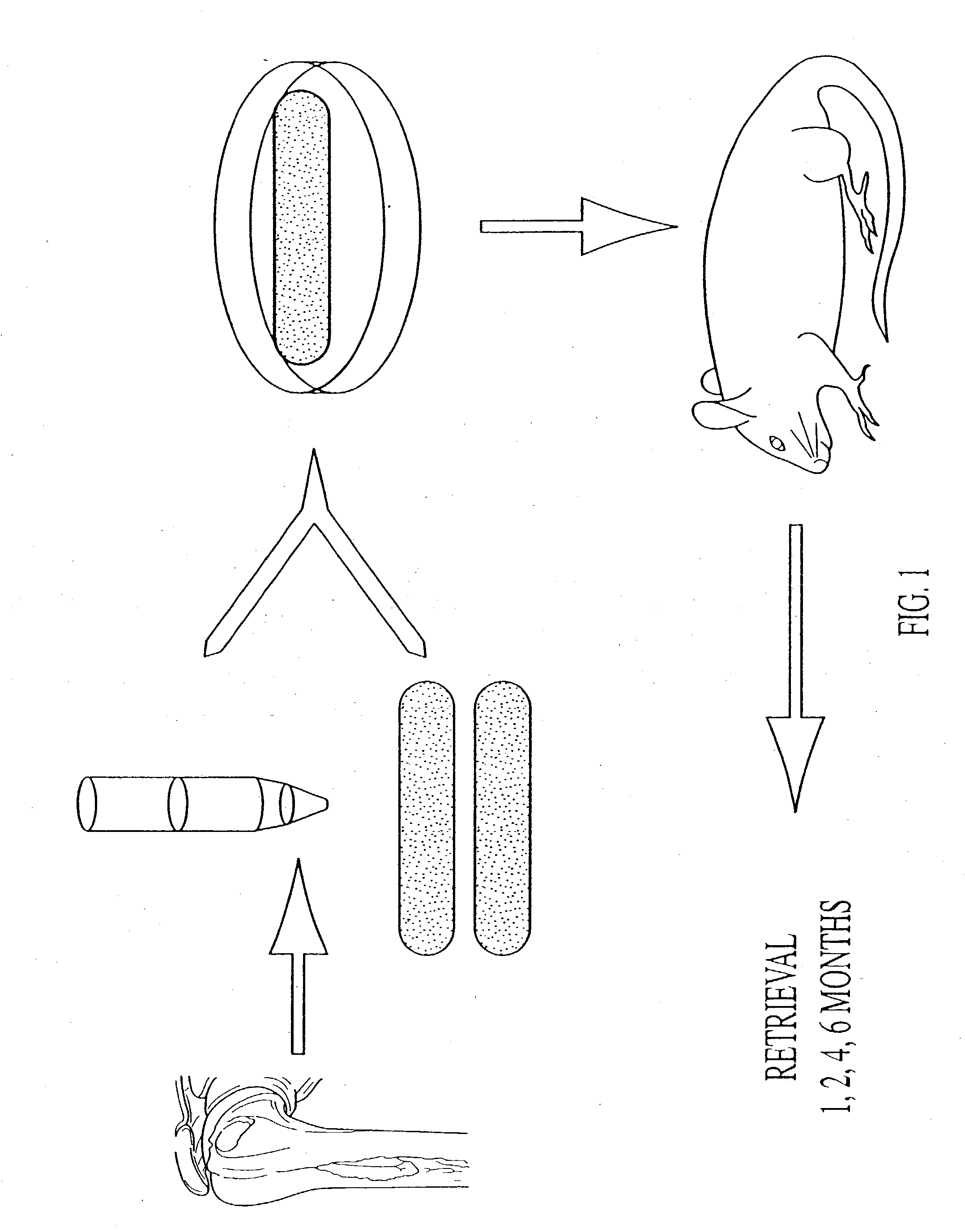 Penile reconstruction