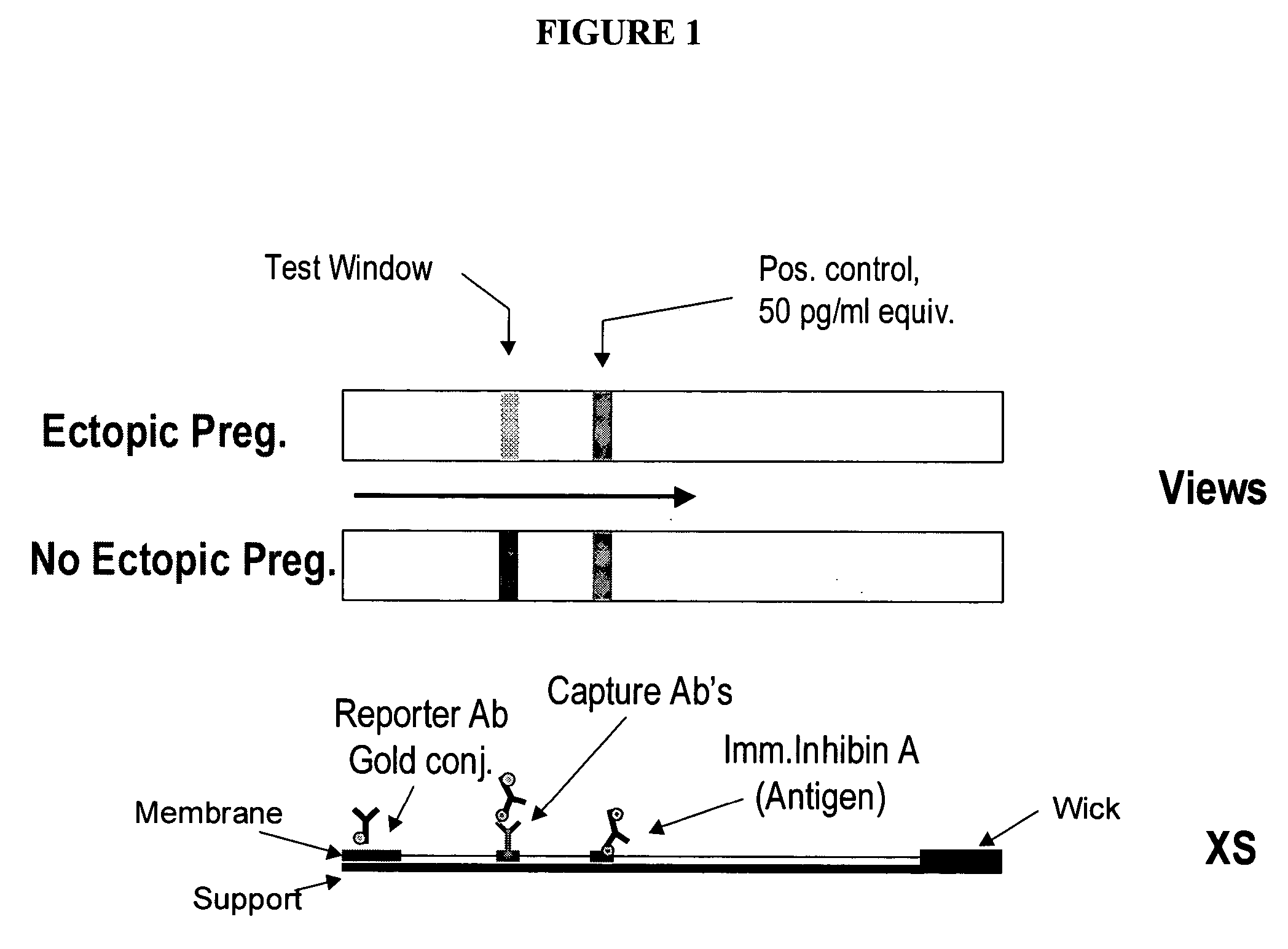 Inhibin-A: a marker for differentiation, diagnosing and screening abnormal pregnancies