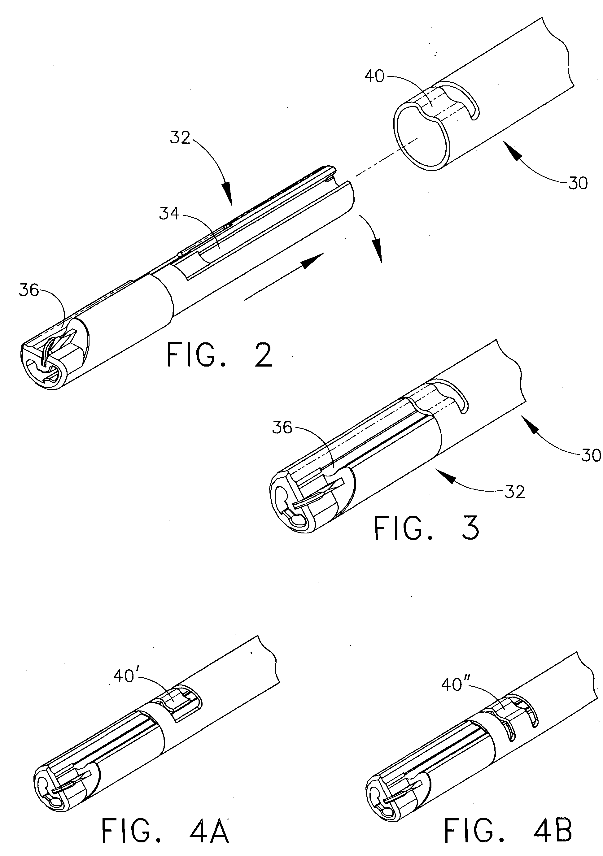 Disposable cartridge for use in a gastric volume reduction procedure