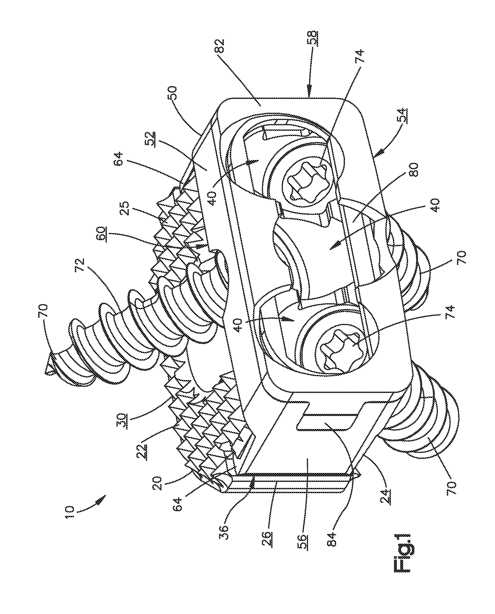 Zero-Profile Interbody Spacer and Coupled Plate Assembly