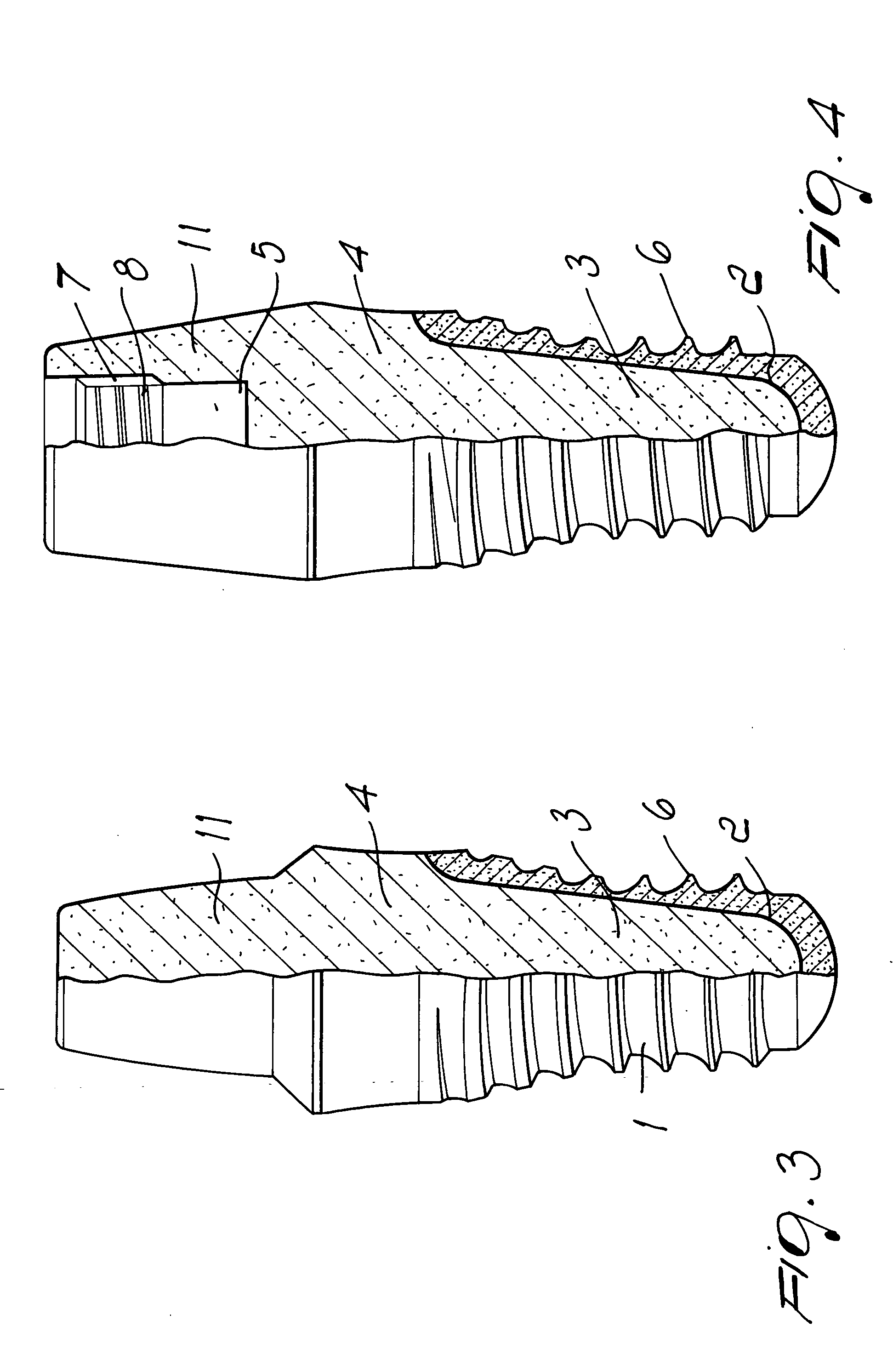 One-piece dental device and method to manufacture the same