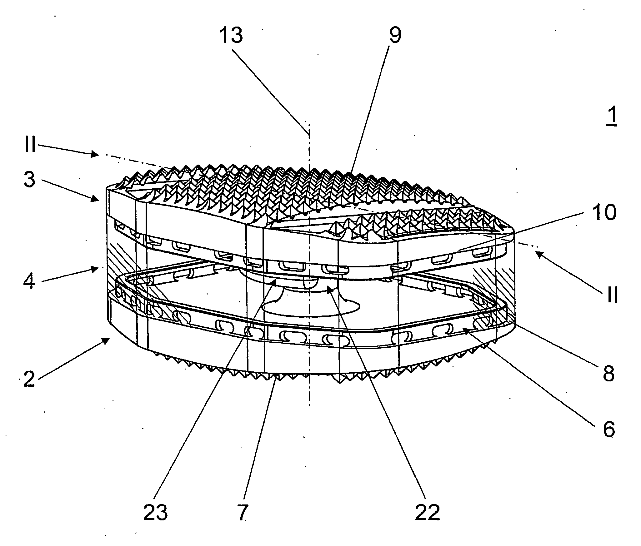 Total disc replacement device