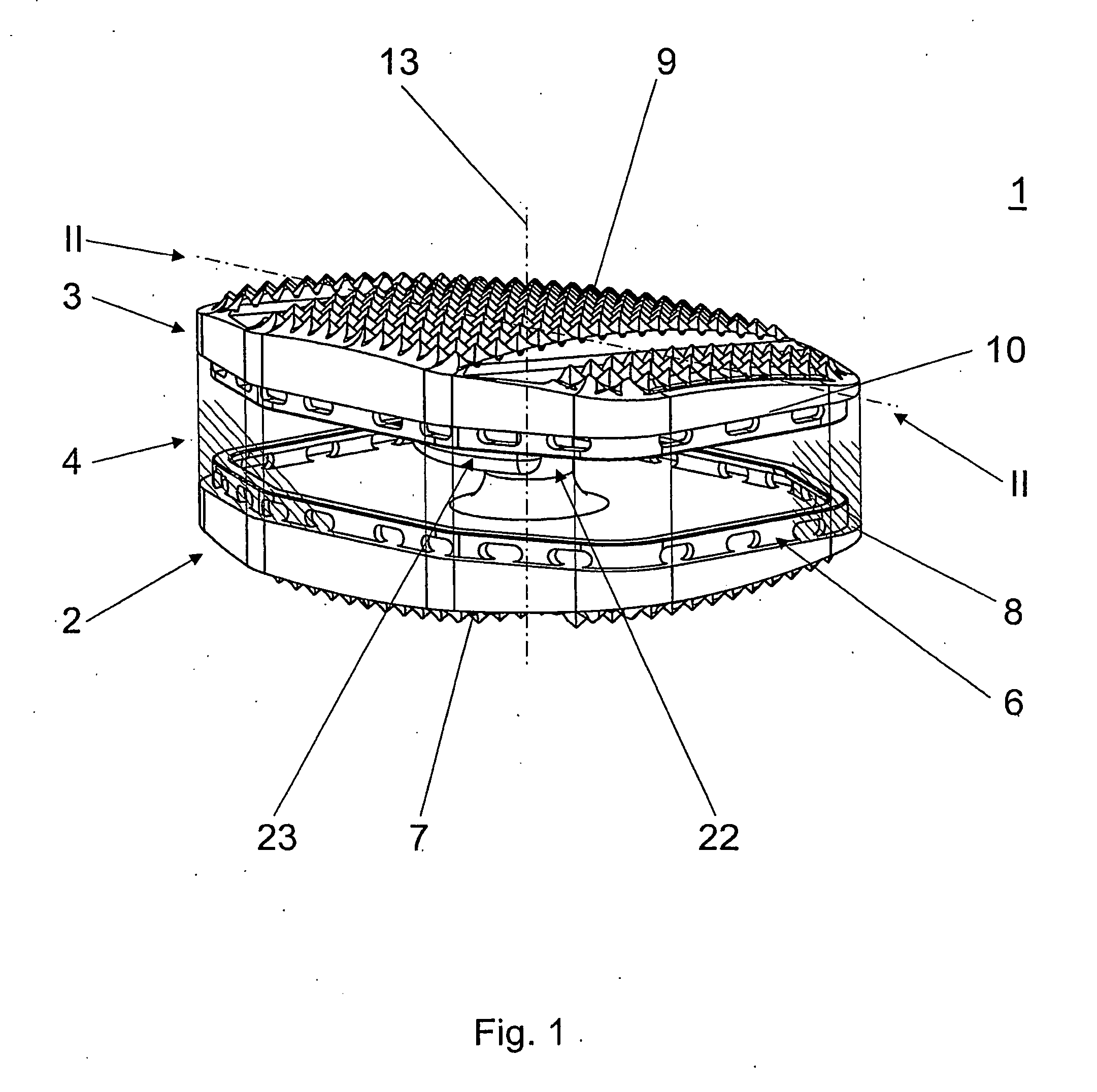 Total disc replacement device