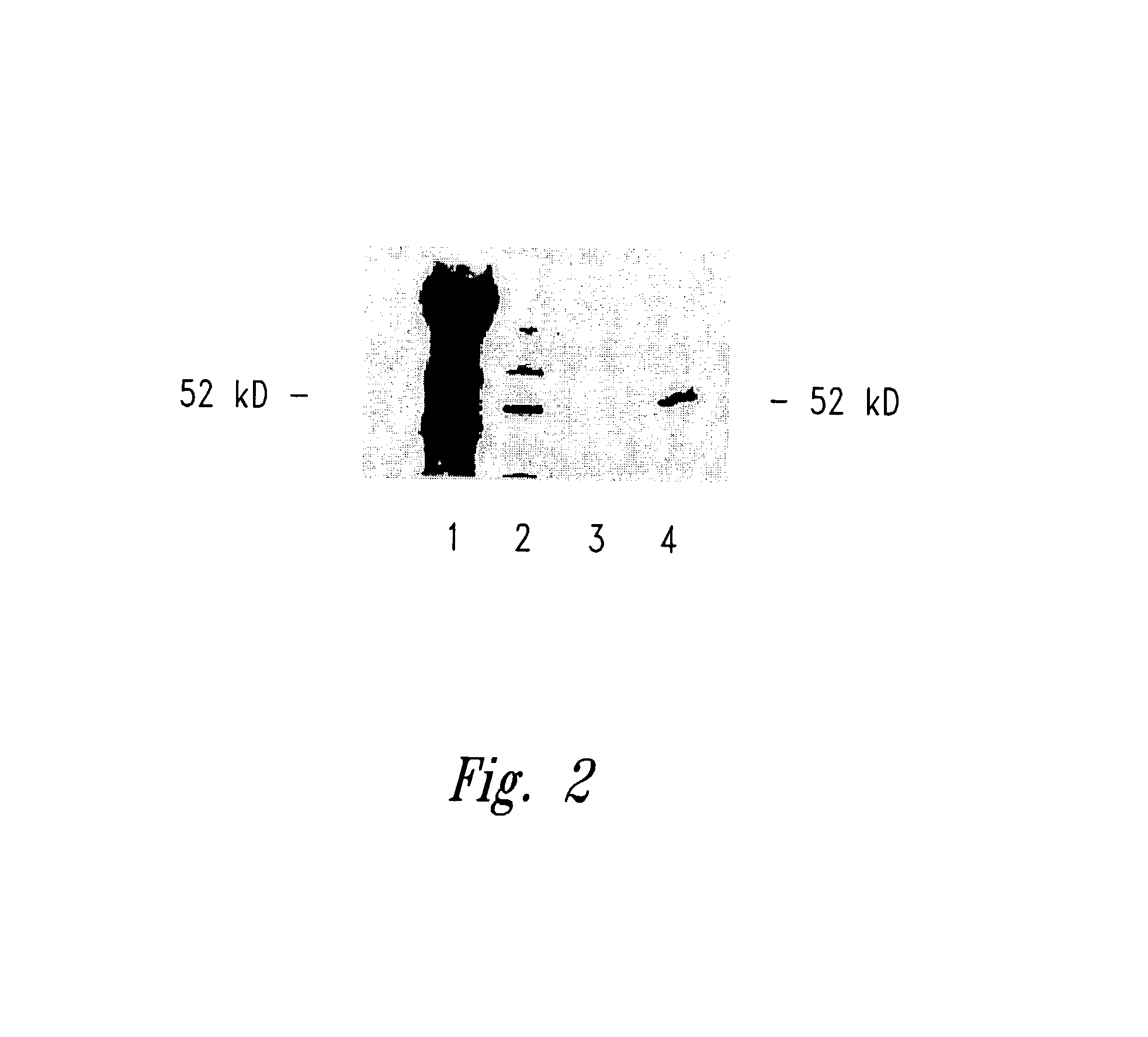 WT1 fusion proteins