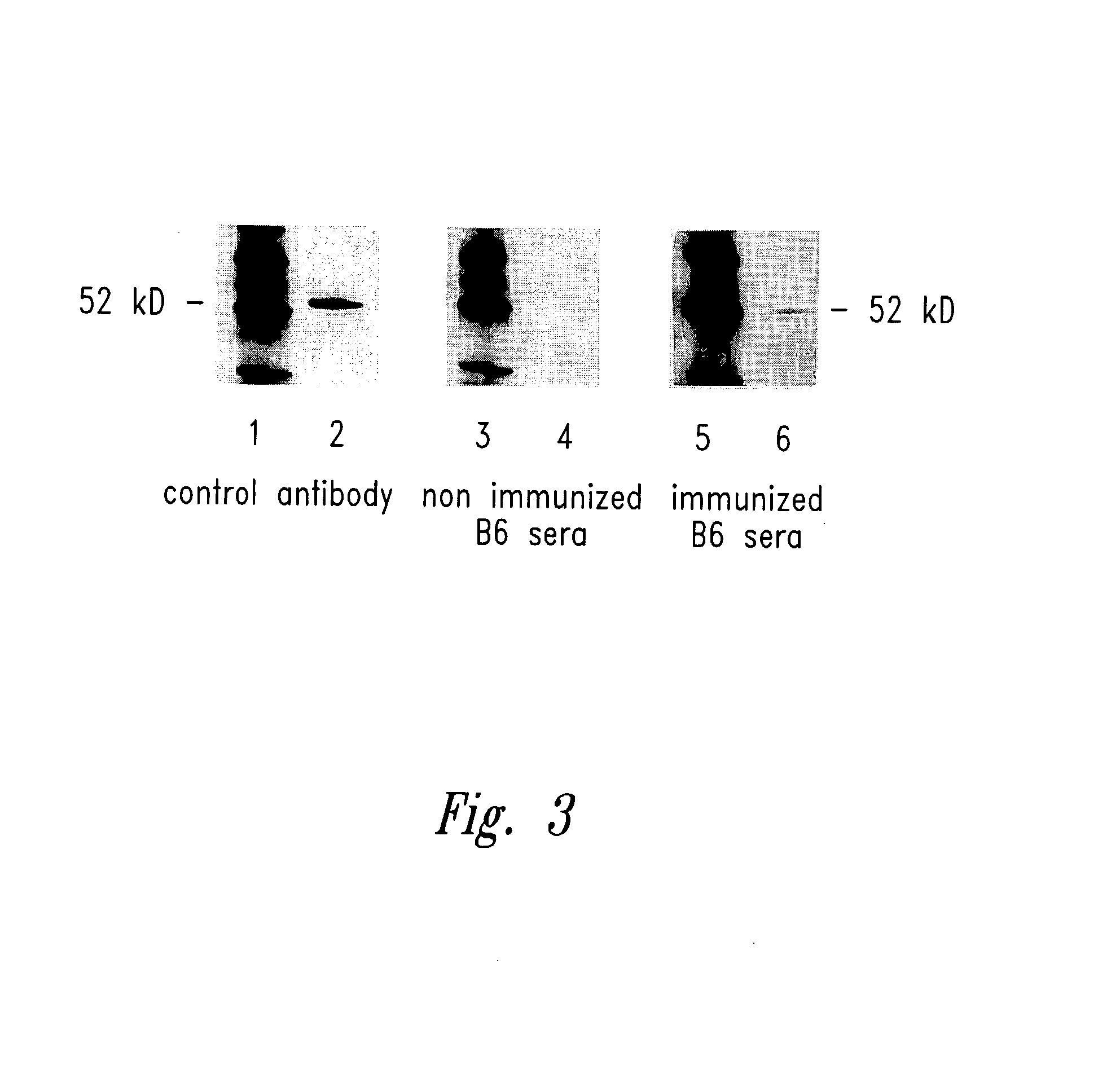 WT1 fusion proteins