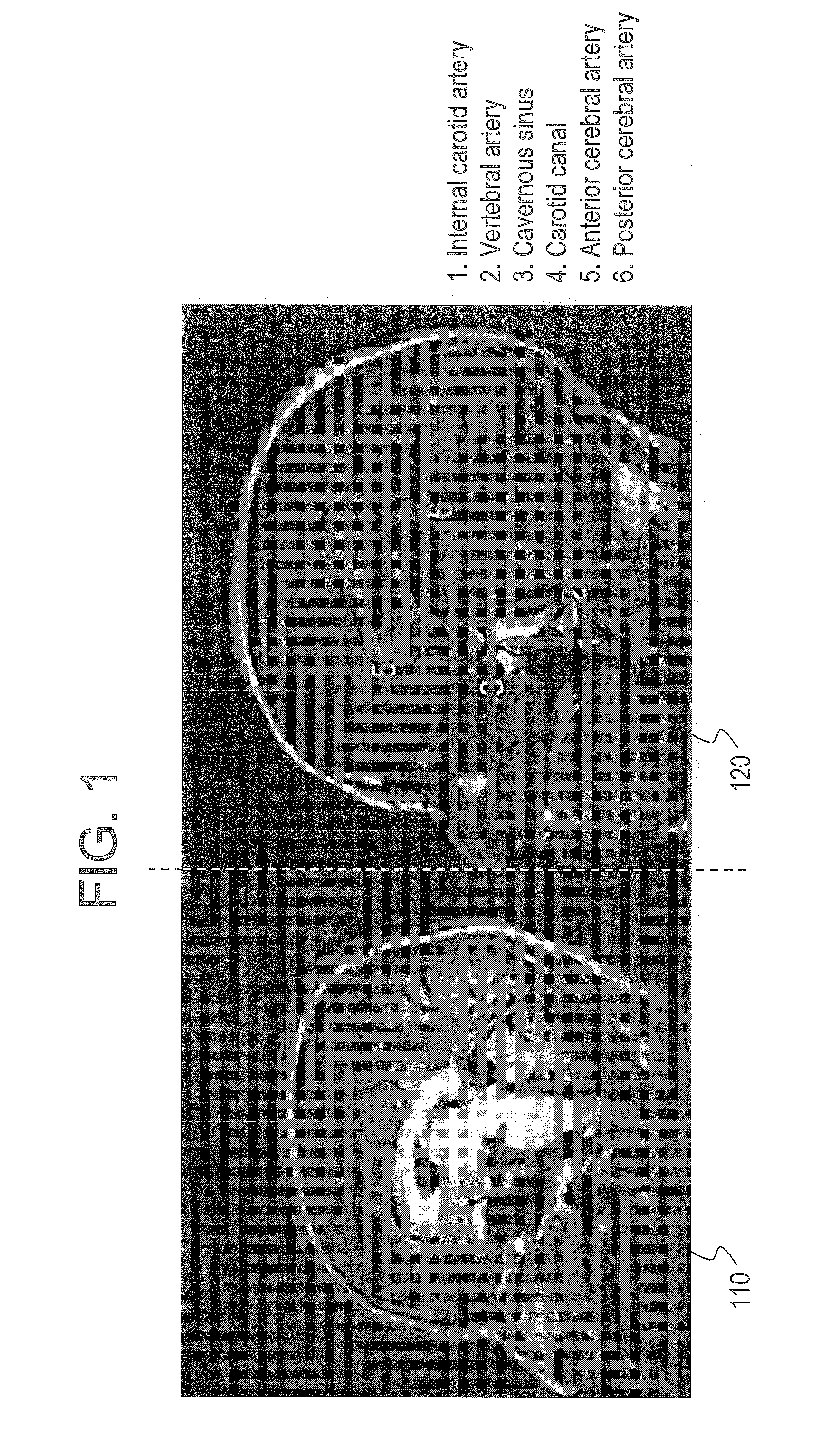 Systems and methods for synchronized image viewing with an image atlas