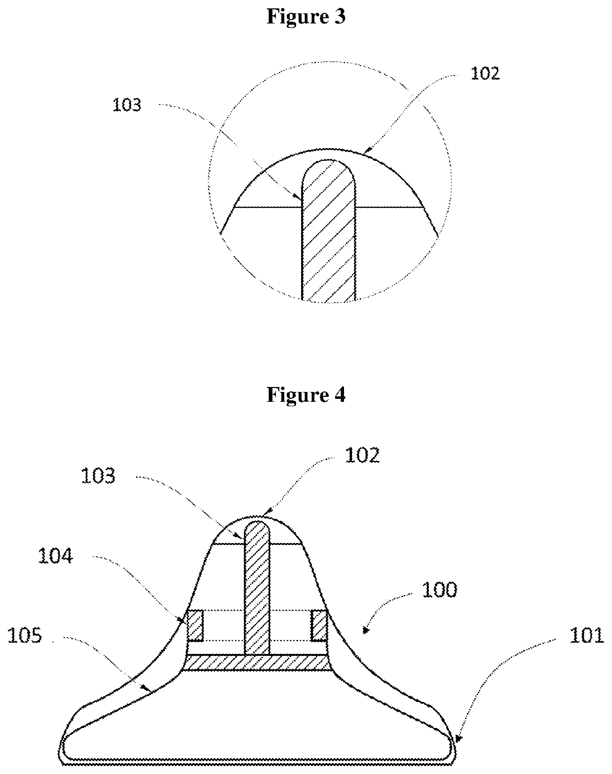 Device for acupuncture and moxibustion therapy and uses thereof