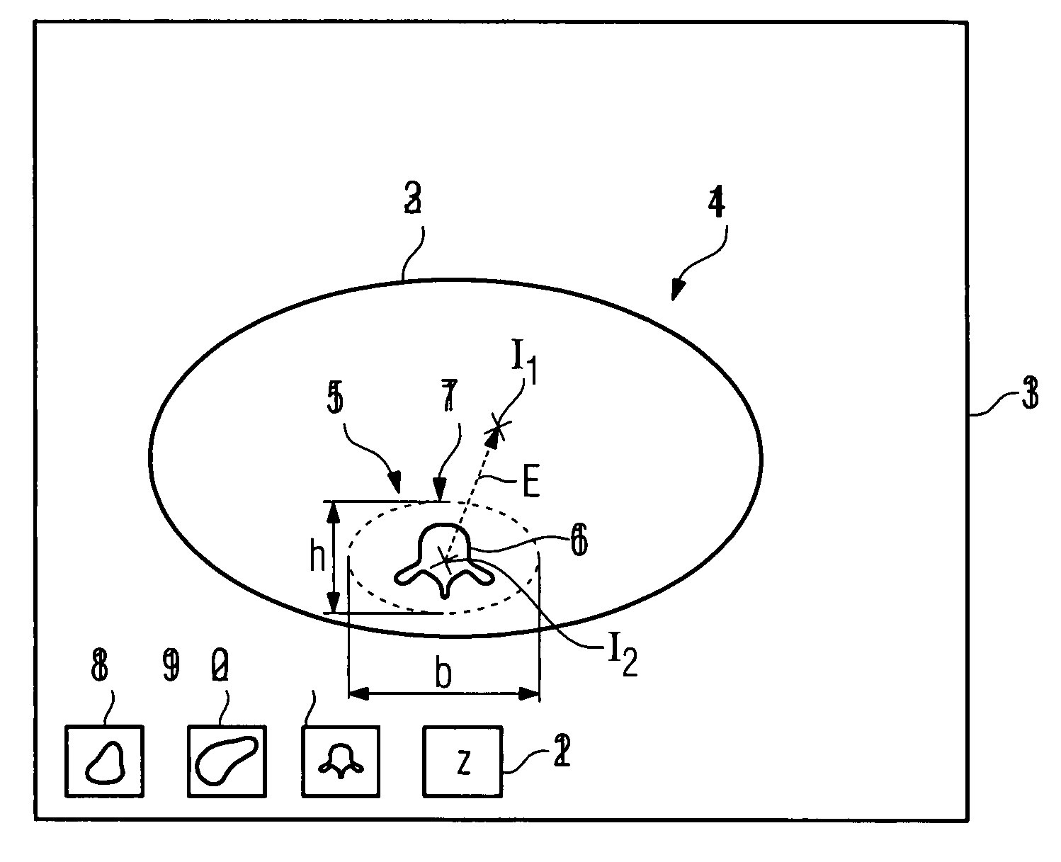 Method for recording images of a definable region of an examination object using a computed tomography facility