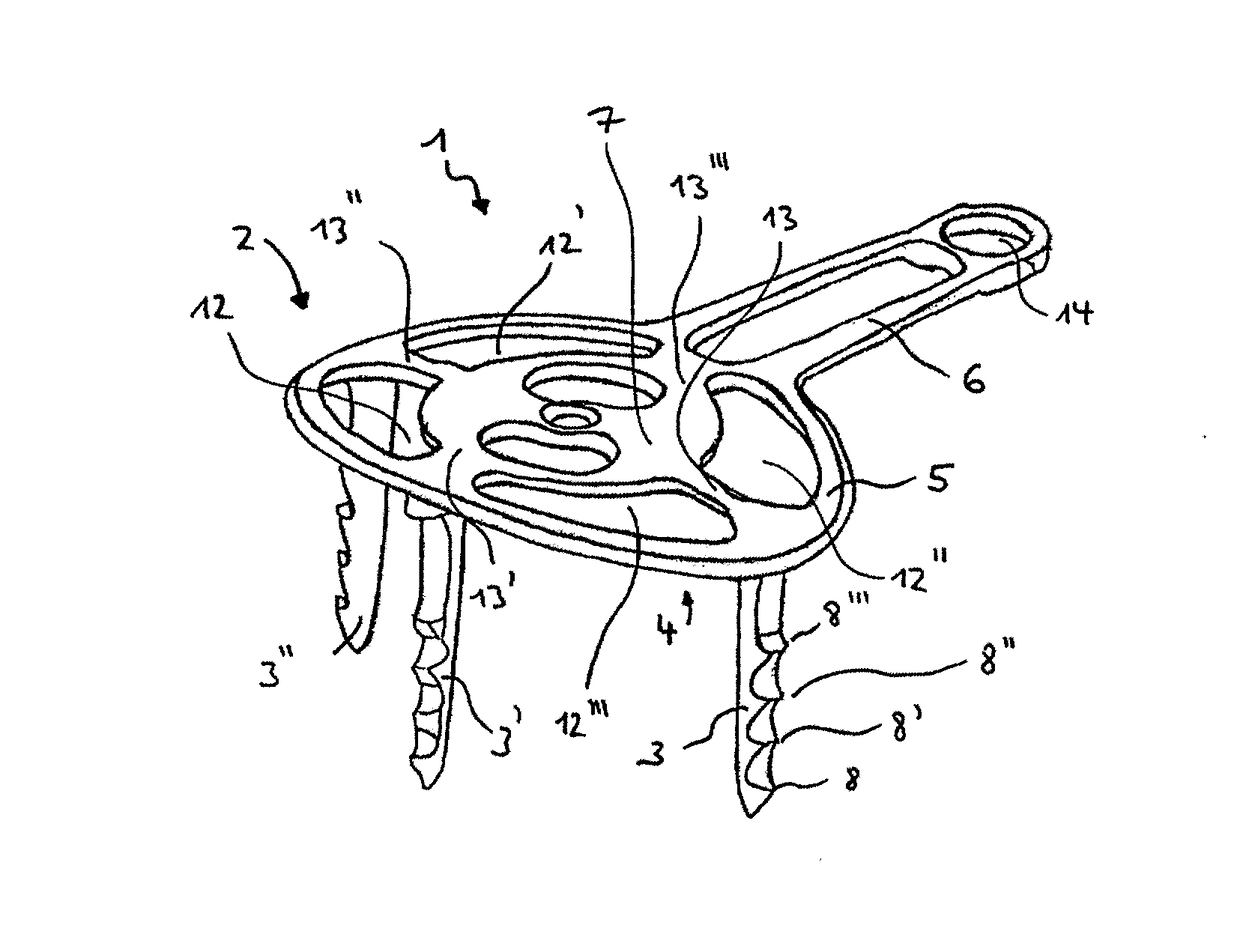 Tendon fixation plate