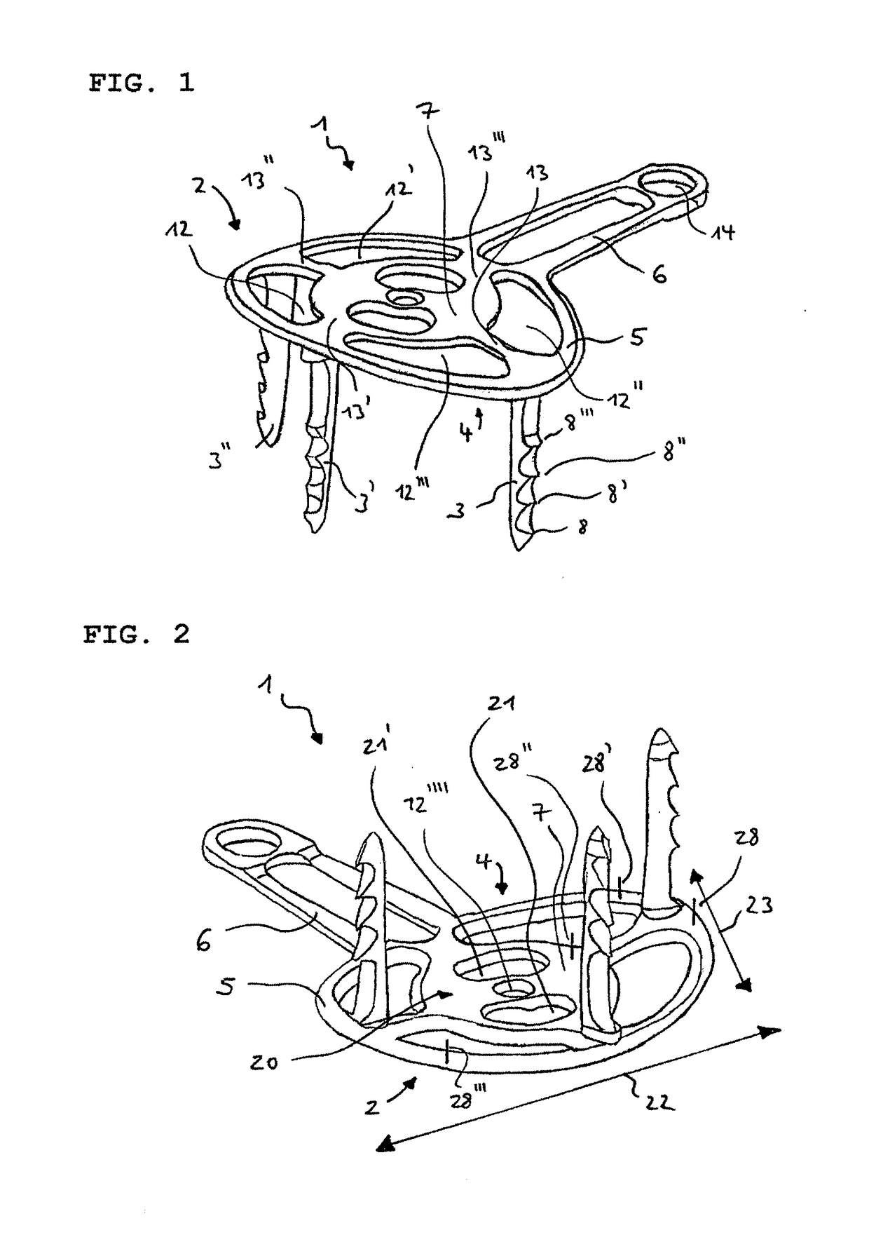 Tendon fixation plate