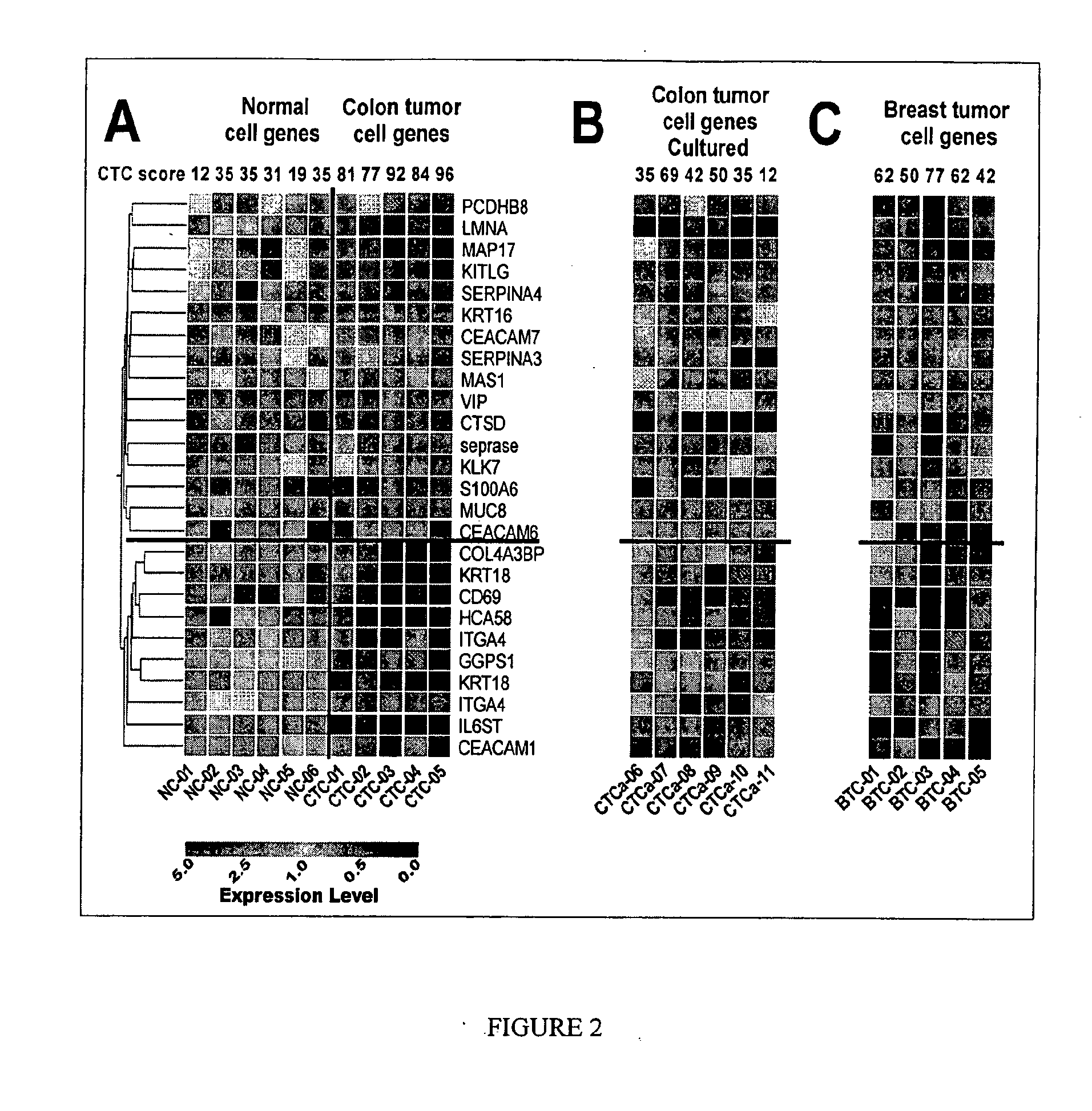 Gene expression signatures in enriched tumor cell samples