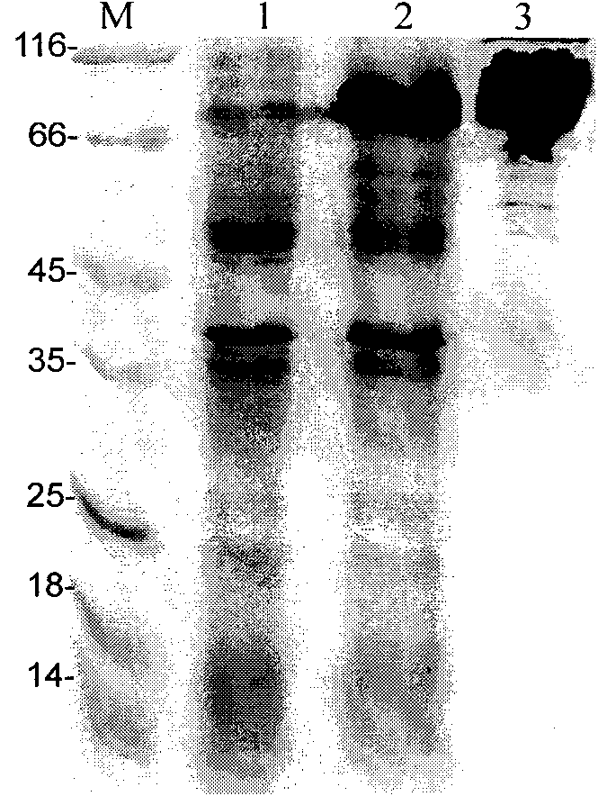 Malaria recombinant antigen, IgY immune body and malaria detection kit