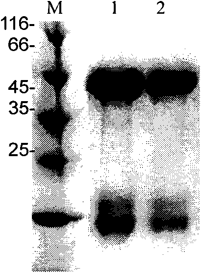 Malaria recombinant antigen, IgY immune body and malaria detection kit