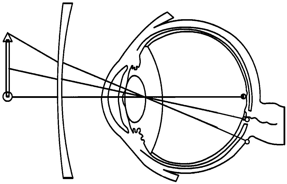 Lenses, glasses and methods for obtaining defocusing amount parameters, ophthalmic dispensing and evaluating effect