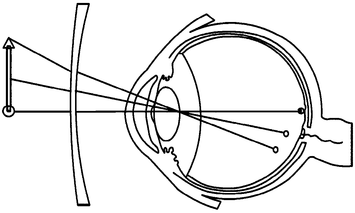 Lenses, glasses and methods for obtaining defocusing amount parameters, ophthalmic dispensing and evaluating effect