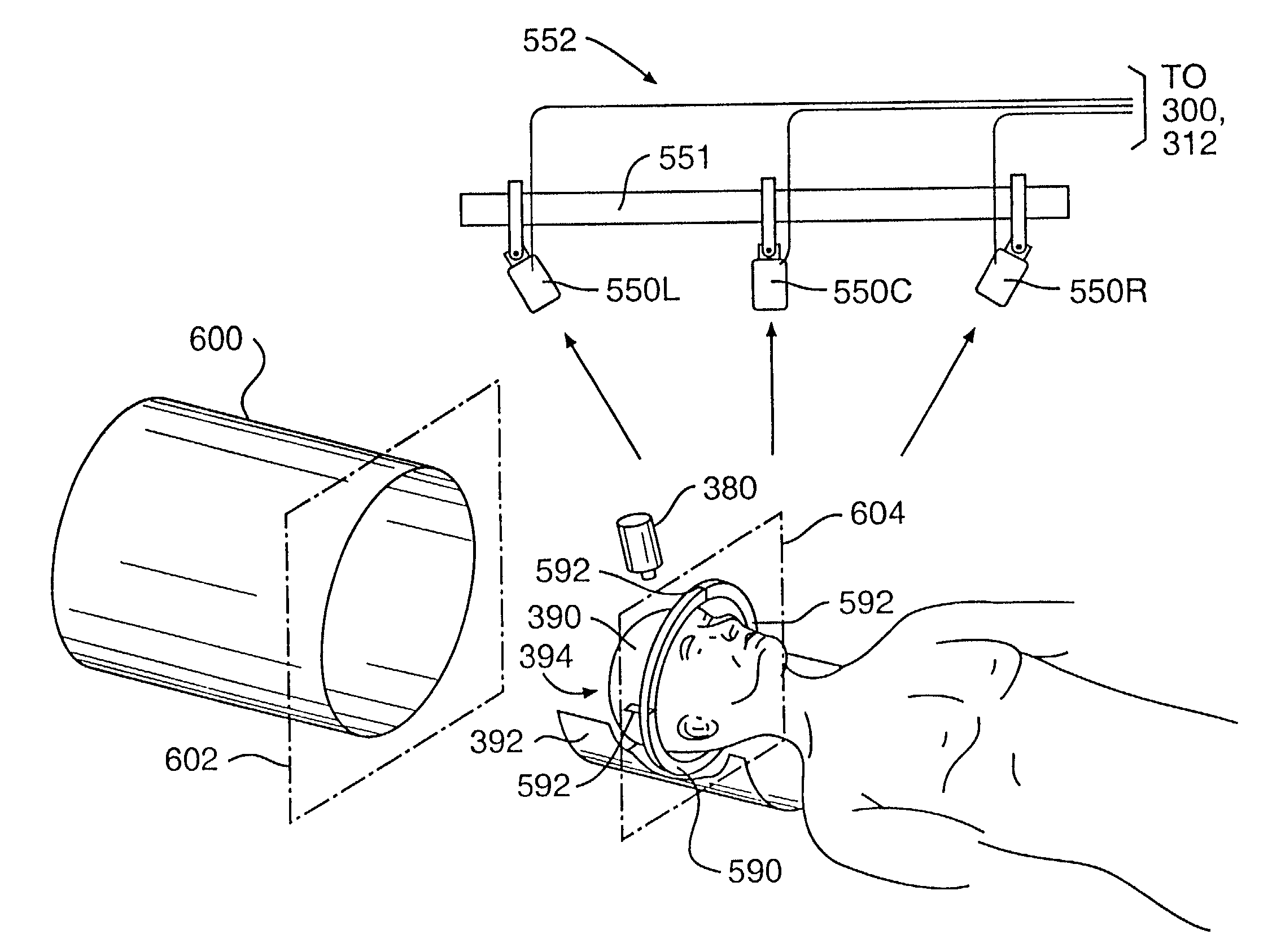System for indicating the position of a surgical probe within a head on an image of the head