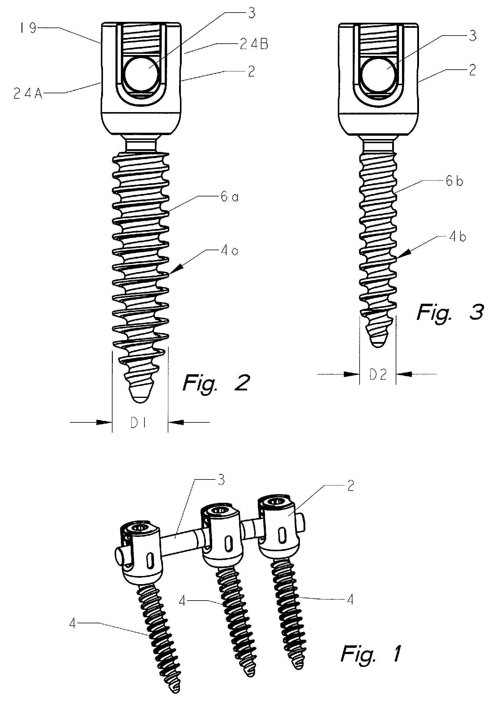 Polyaxial bone screw