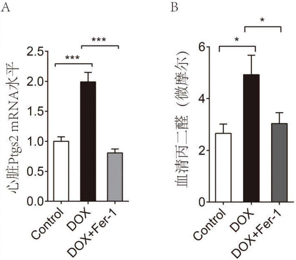 Application of Ferrostatin-1 to preparation of medicine for inhibiting cardiotoxicity caused by adriamycin