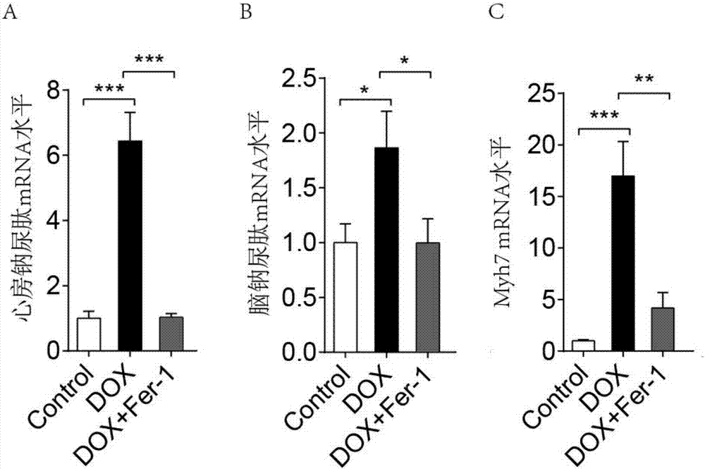 Application of Ferrostatin-1 to preparation of medicine for inhibiting cardiotoxicity caused by adriamycin