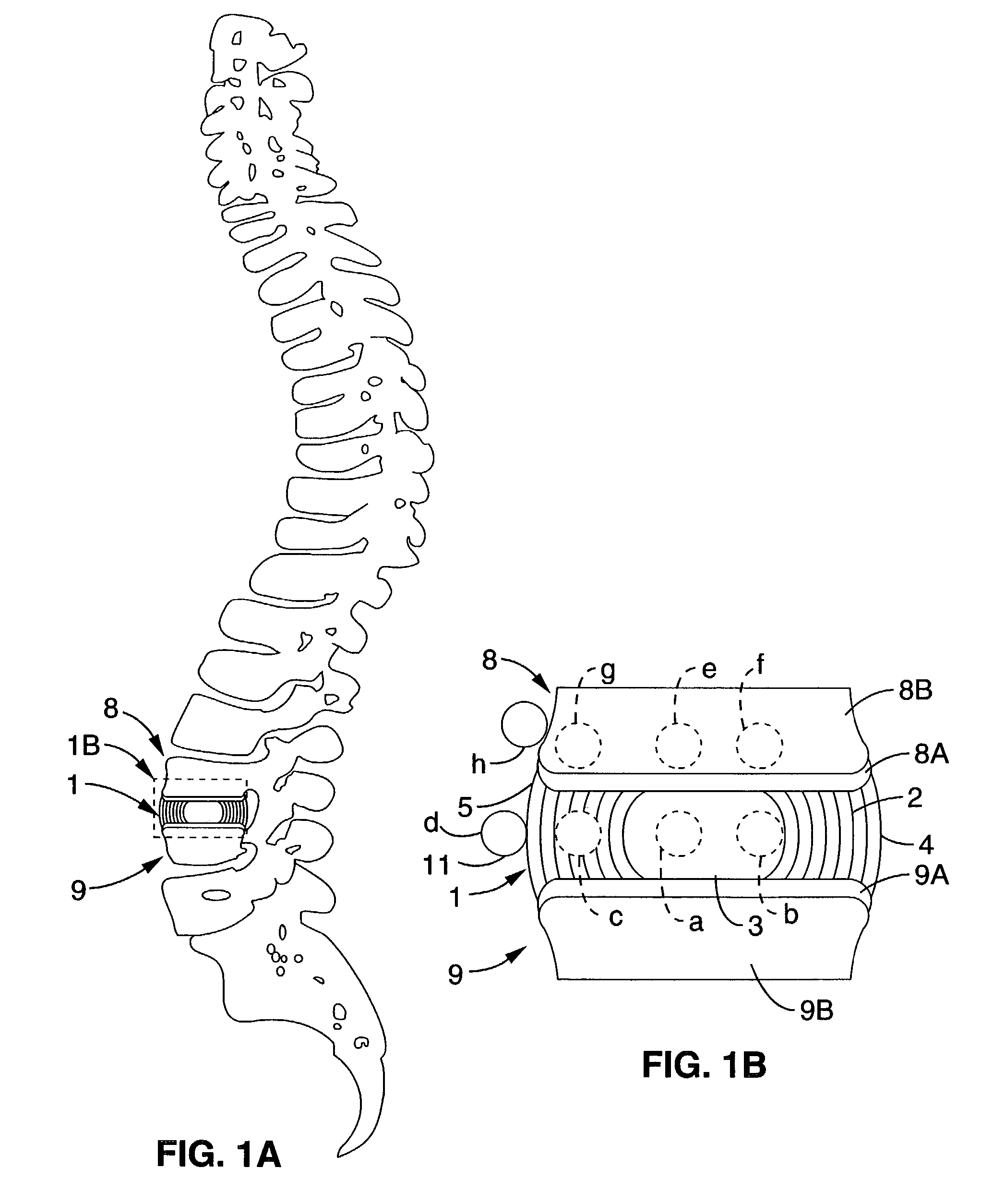 System and method providing directional ultrasound therapy to skeletal joints