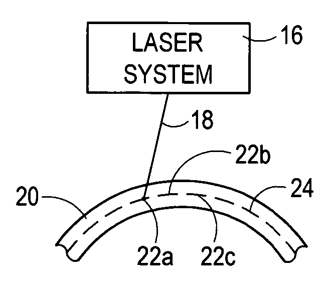 Time-resolved scanning patterns for intrastromal surgery